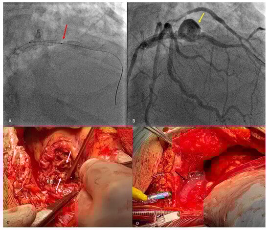 Diagnostics 14 00840 g003
