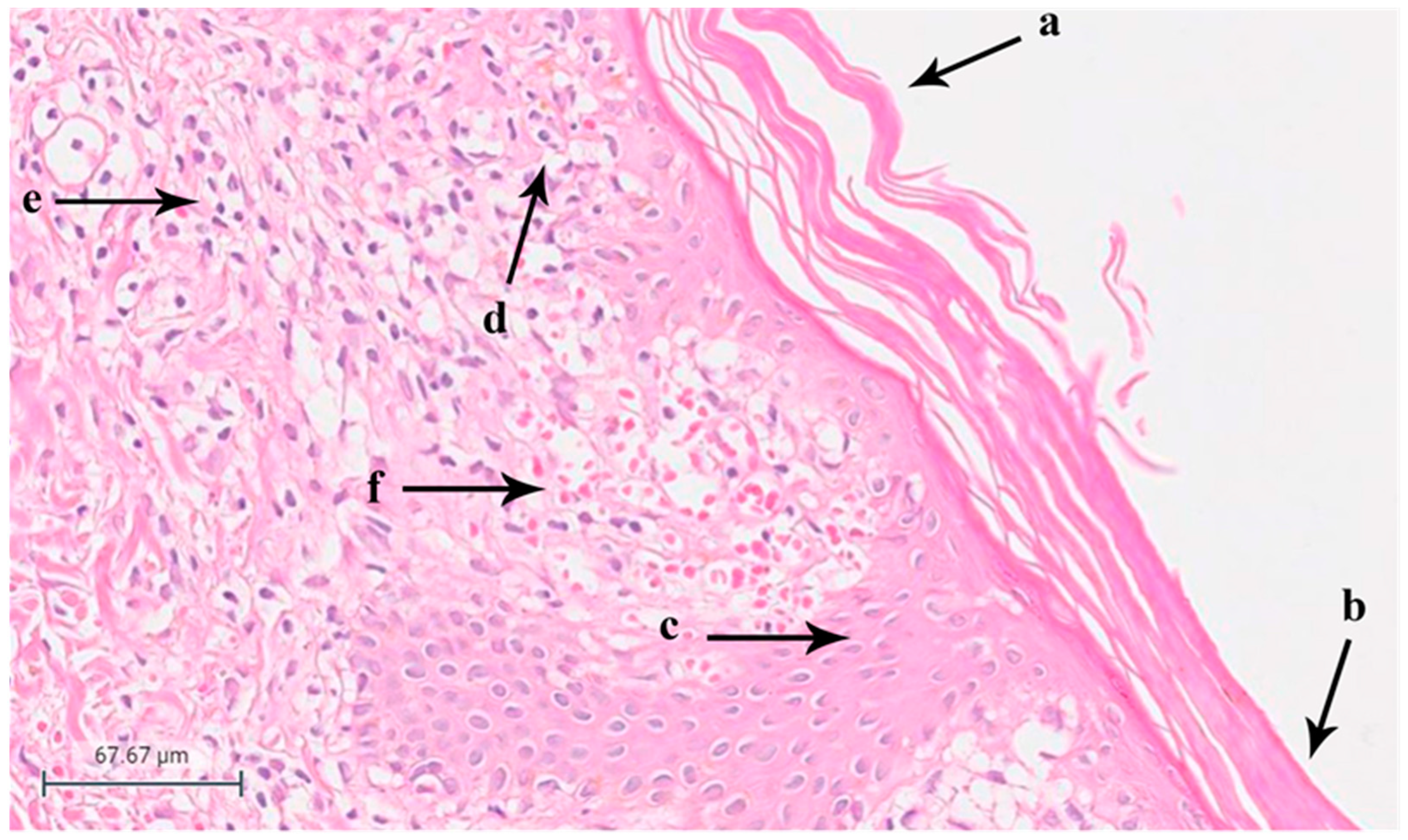 Diagnostics 14 00843 g001
