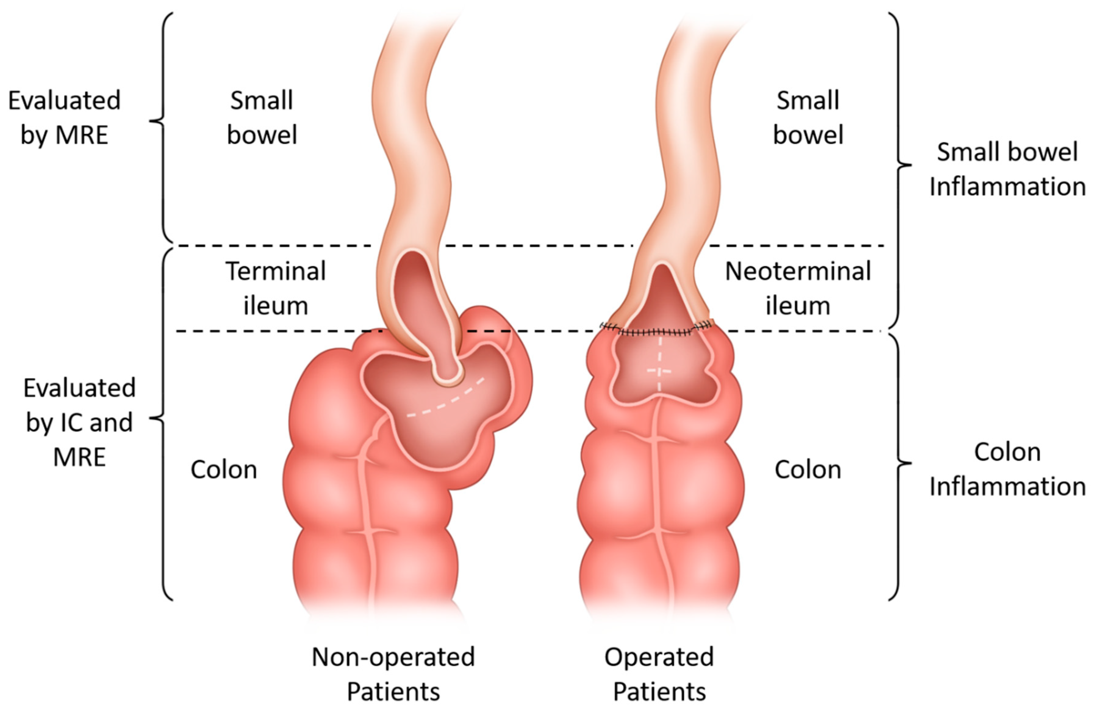 Diagnostics 14 00854 g001