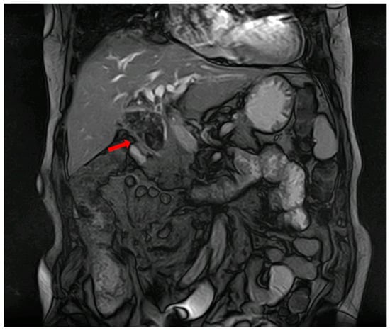 Diagnostics 14 00855 g002