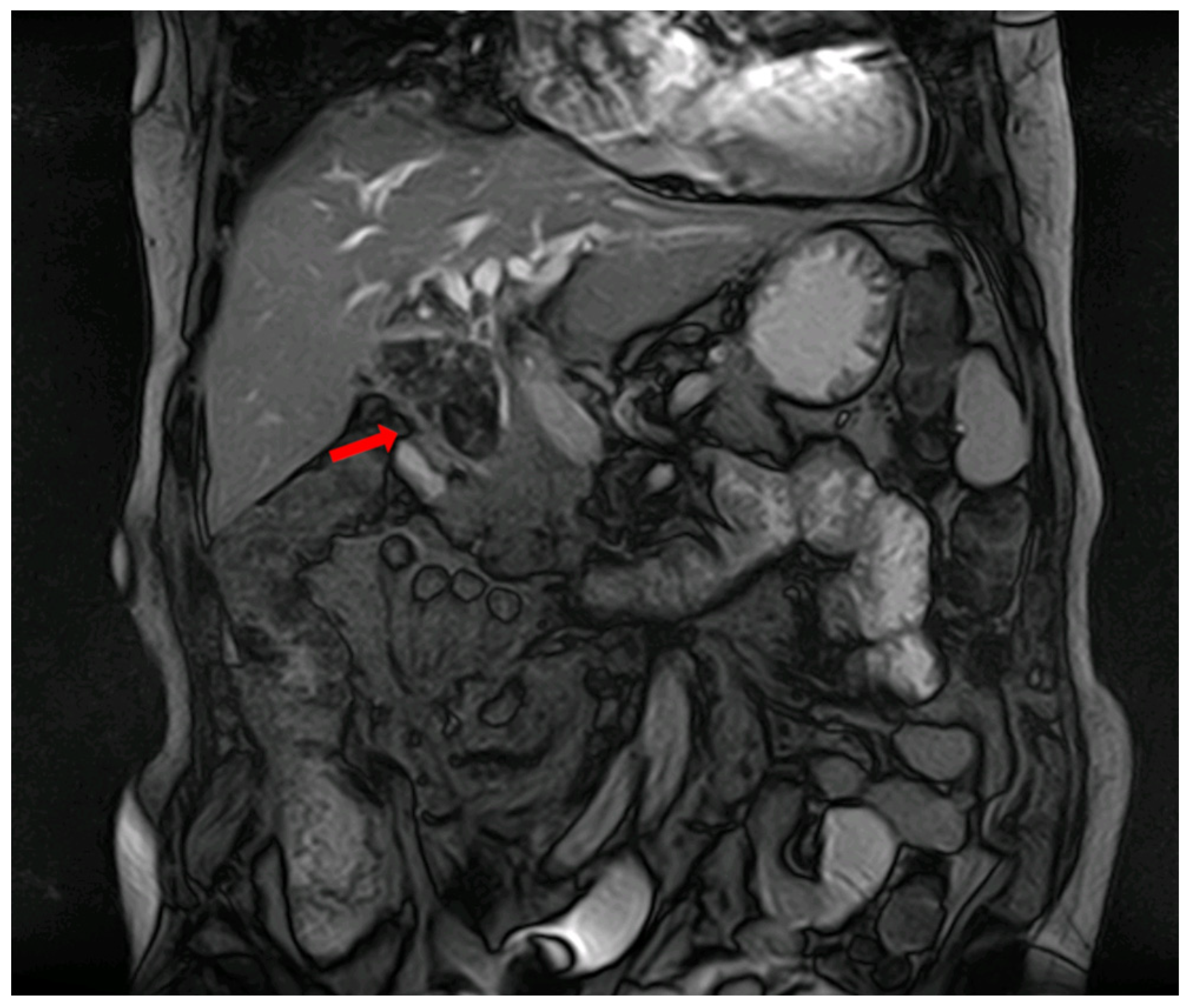 Diagnostics 14 00855 g002