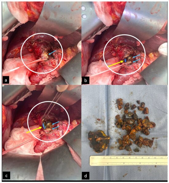 Diagnostics 14 00855 g003