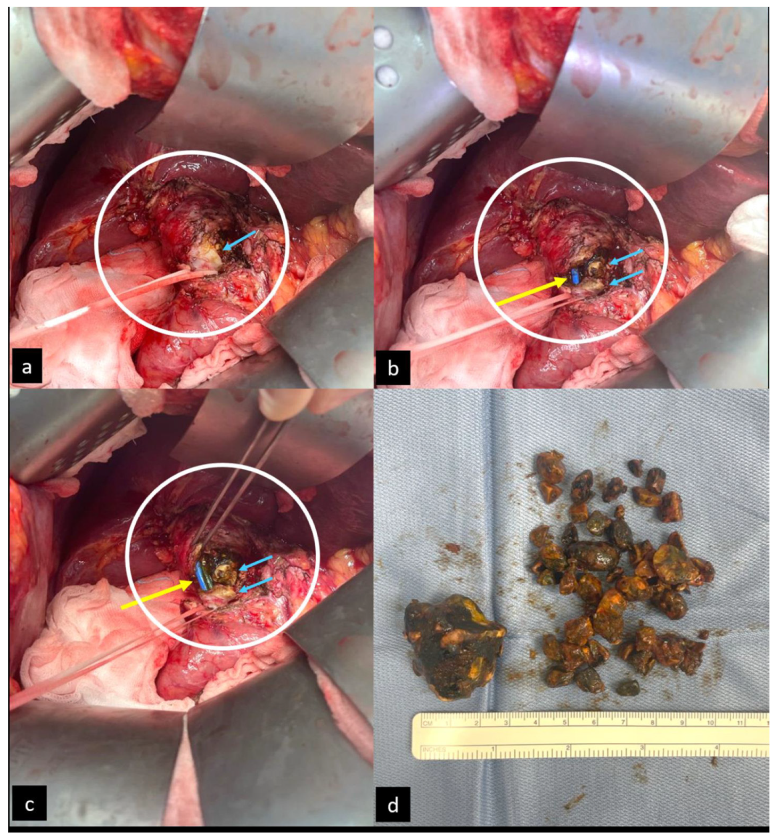 Diagnostics 14 00855 g003