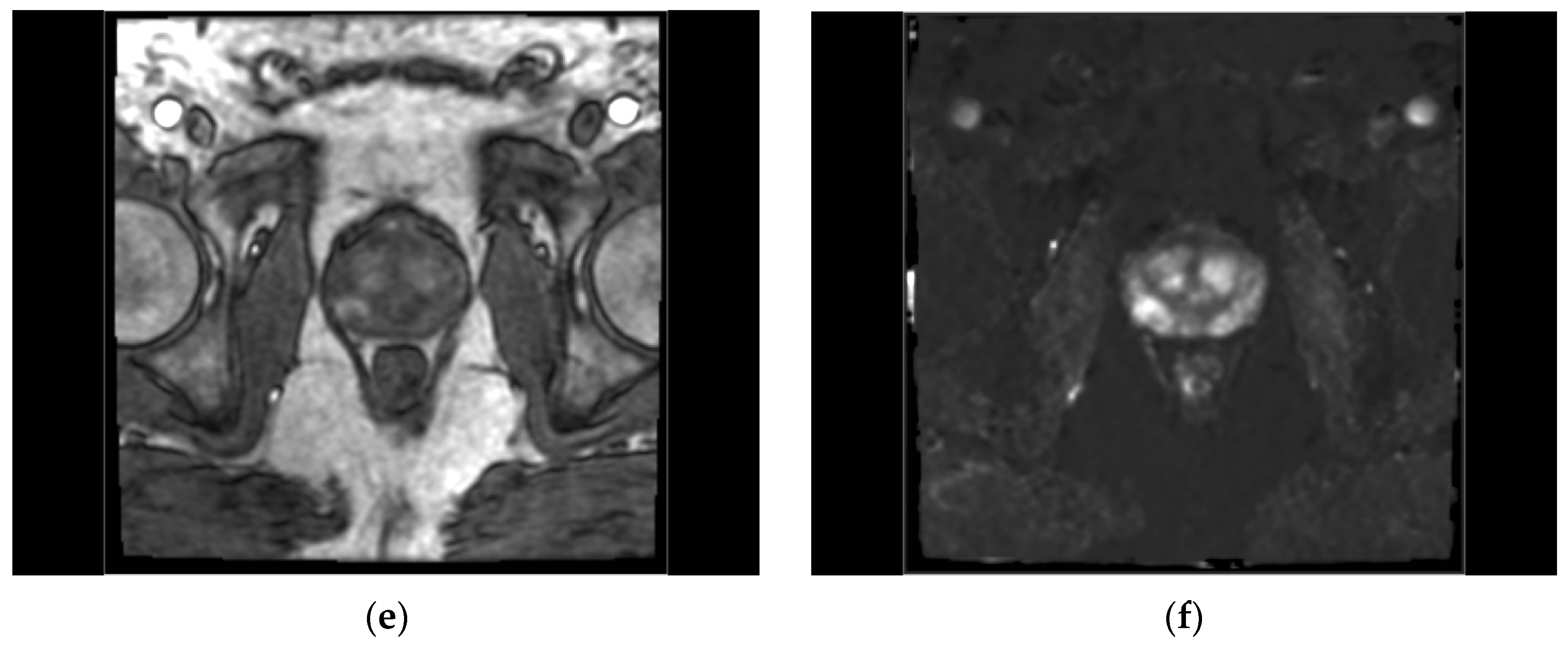 Diagnostics 14 00870 g001b