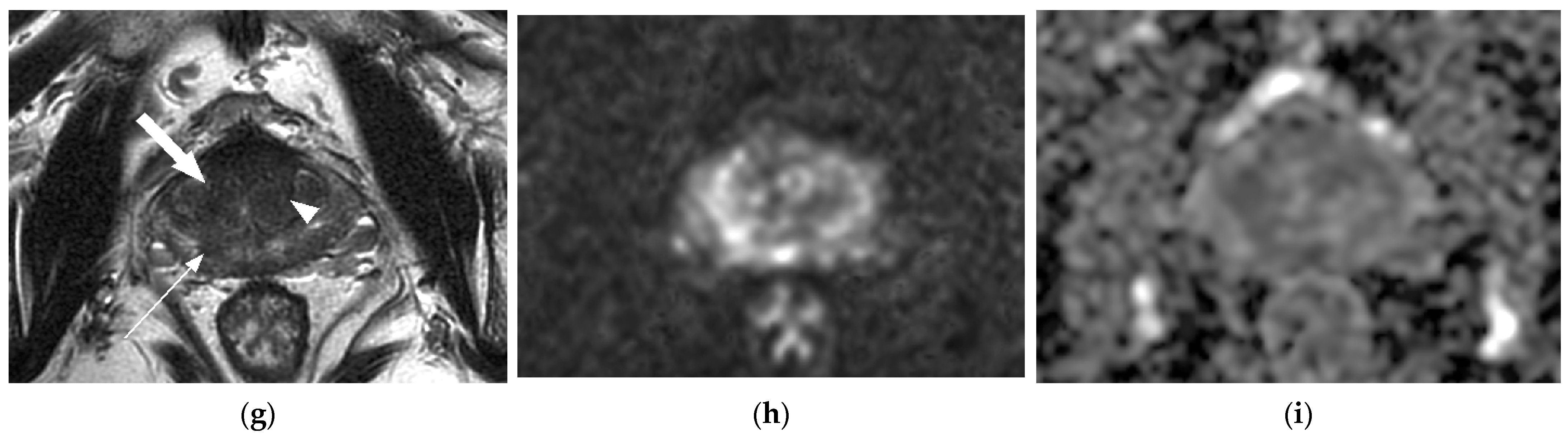 Diagnostics 14 00870 g005b