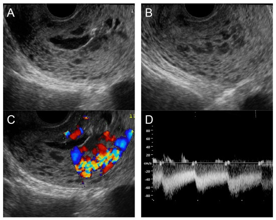 Diagnostics 14 00873 g005