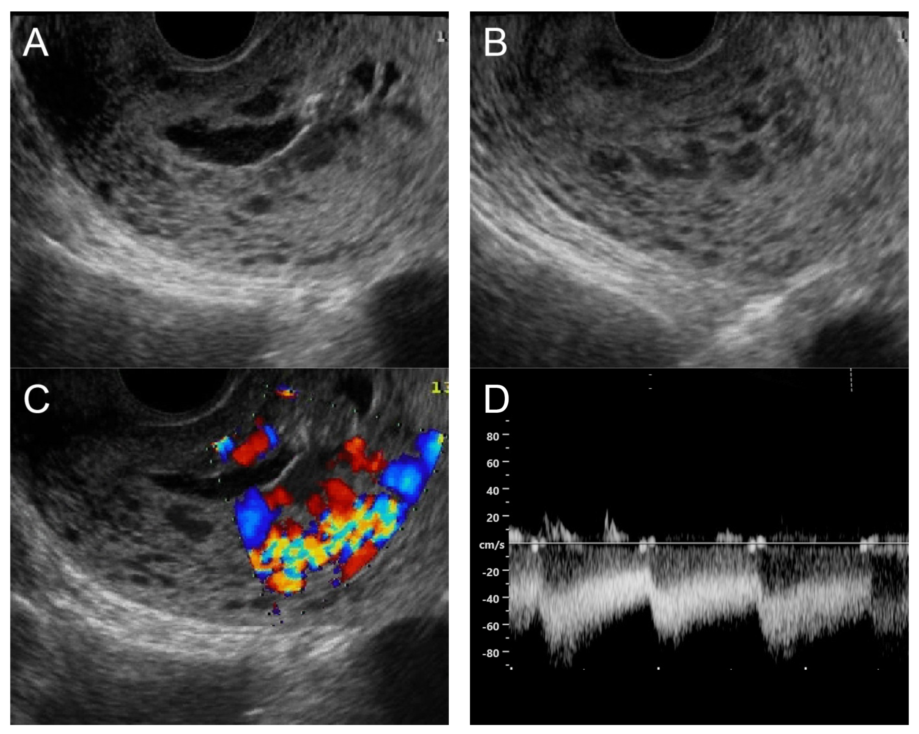 Diagnostics 14 00873 g005