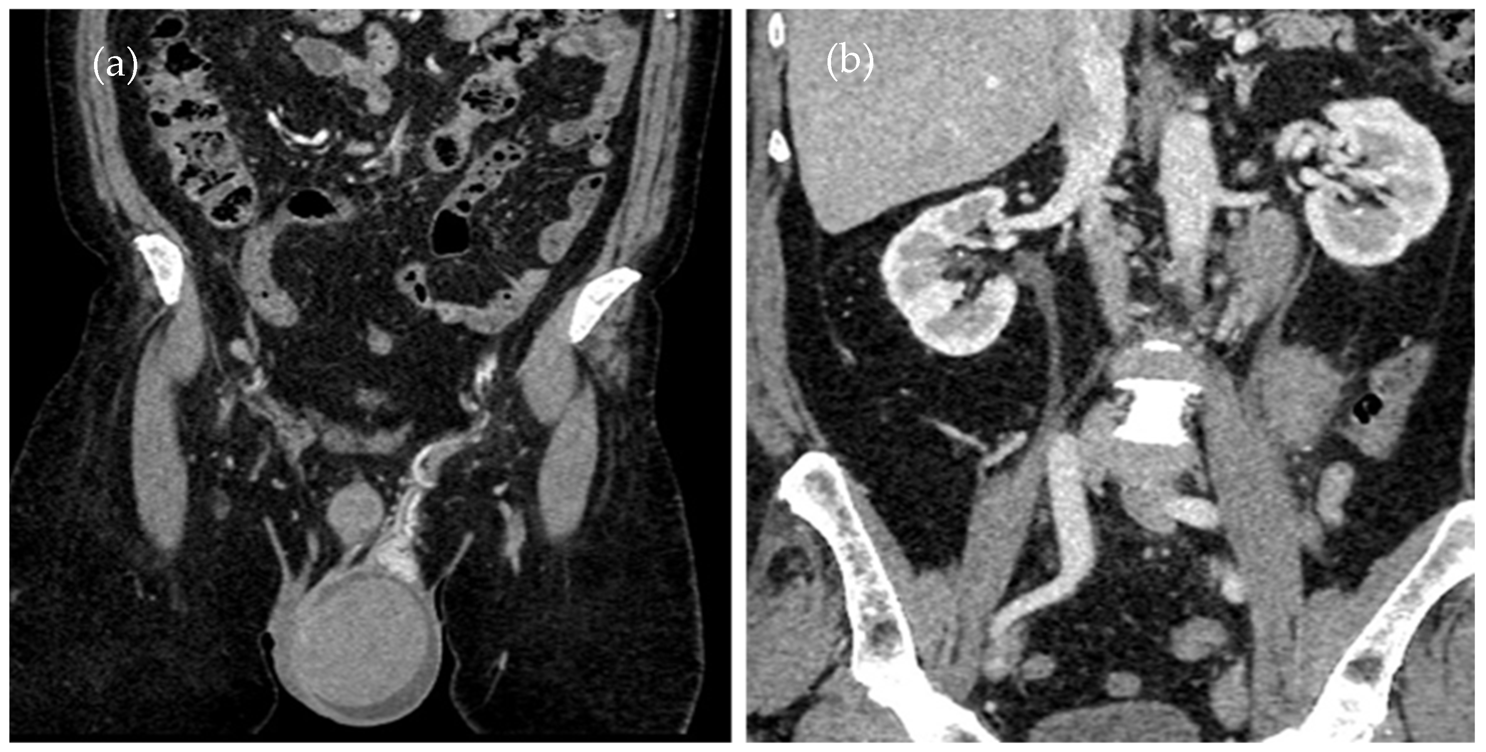 Diagnostics 14 00875 g001