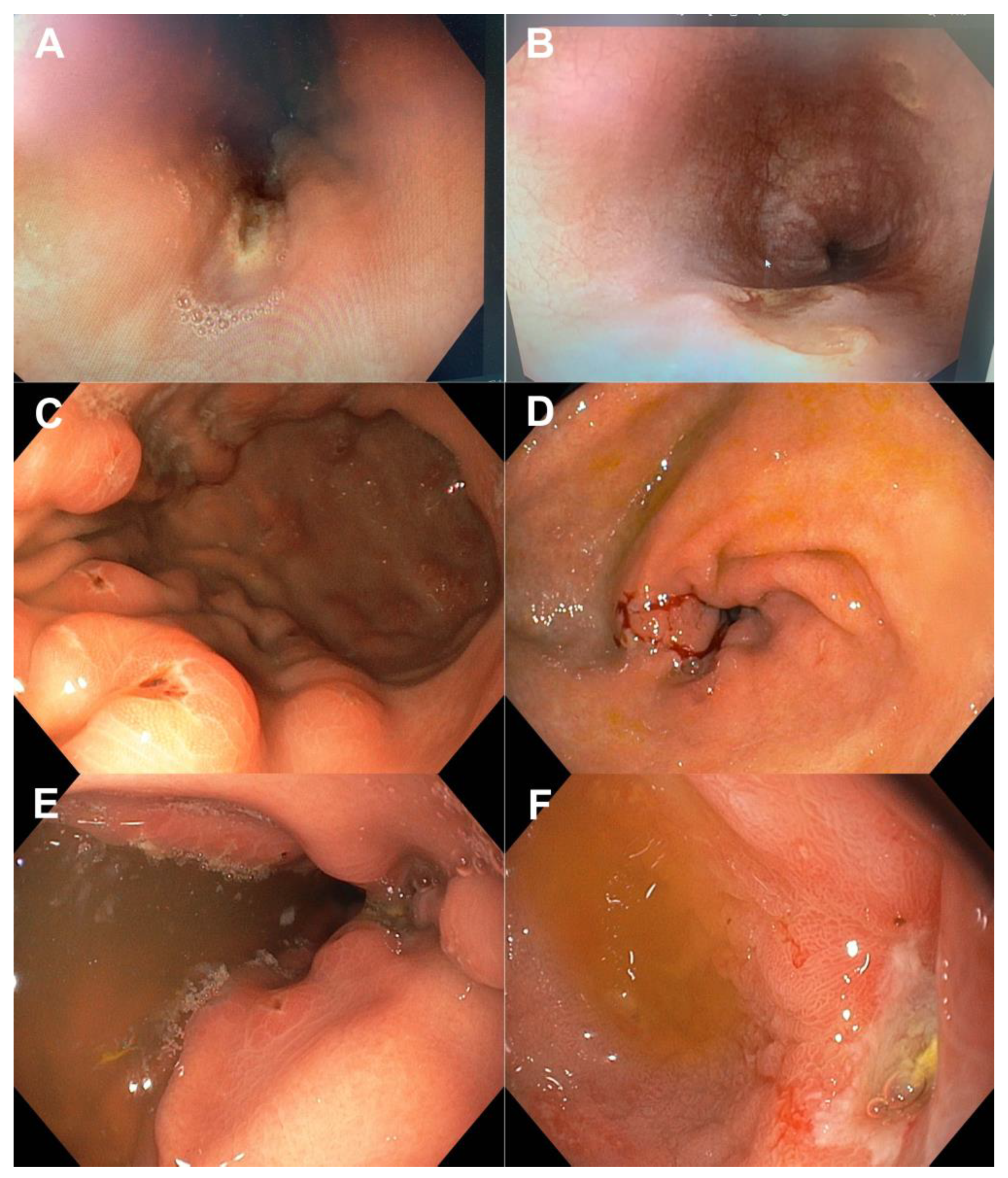 Diagnostics 14 00877 g002
