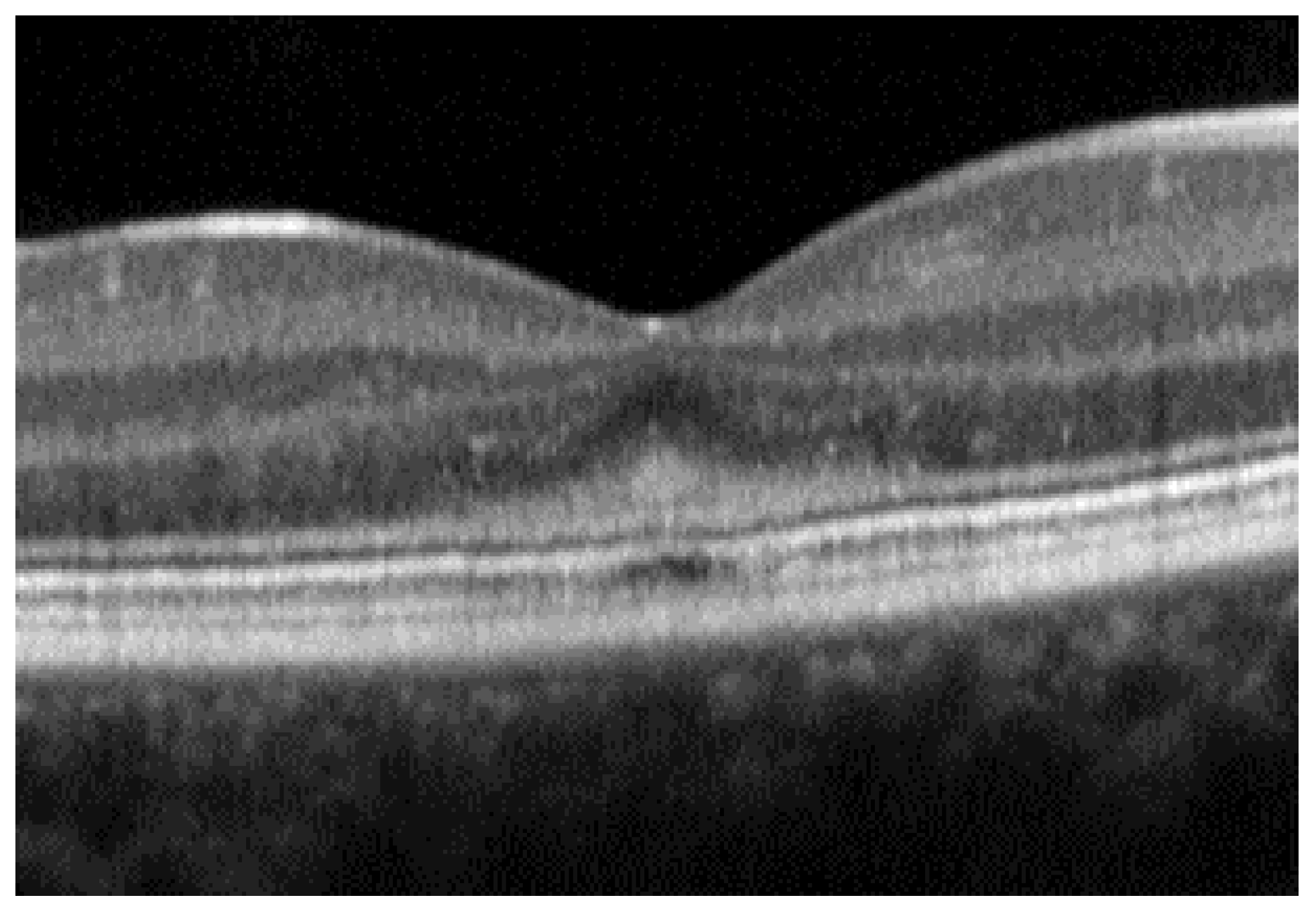 Diagnostics 14 00878 g002