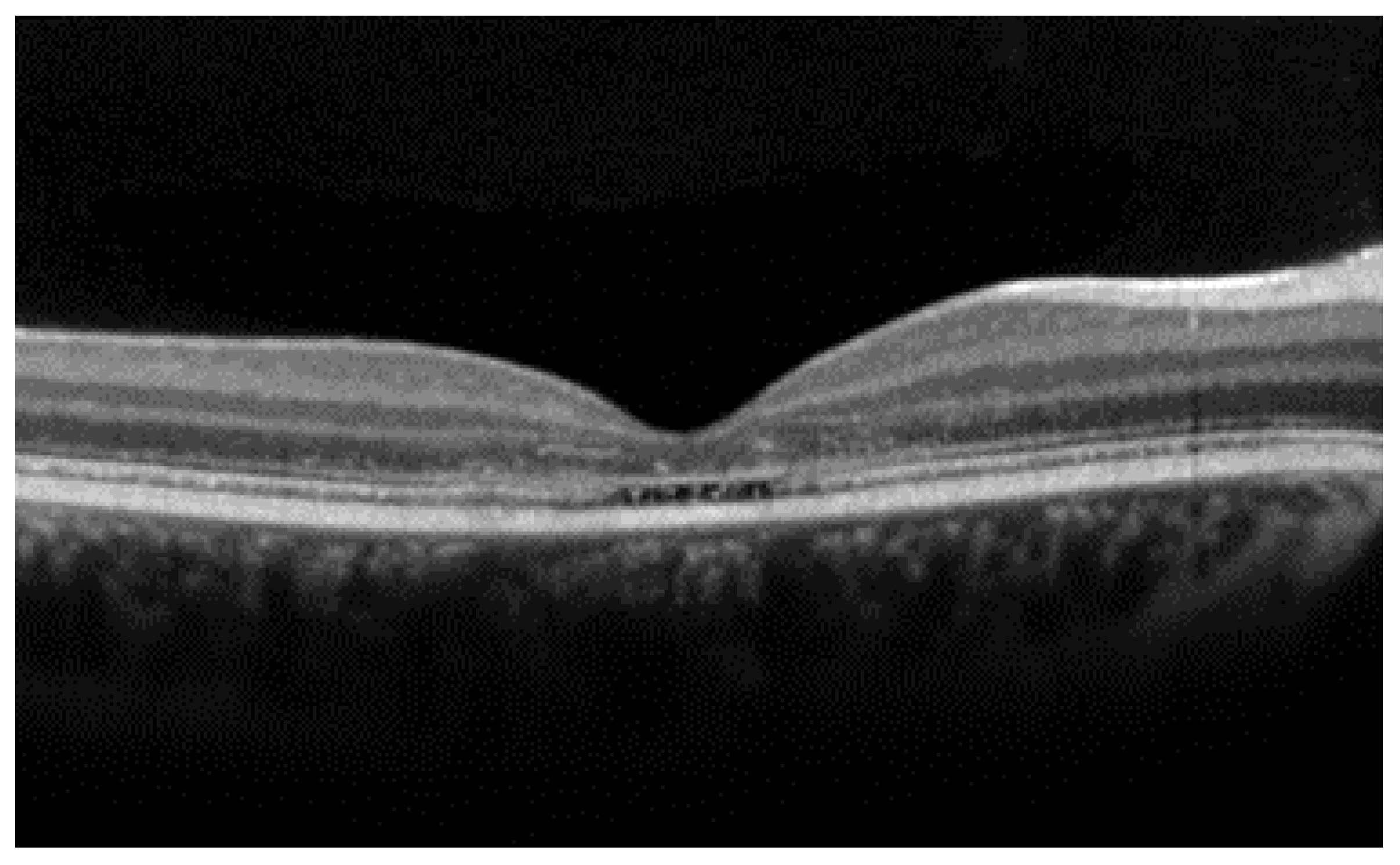 Diagnostics 14 00878 g004