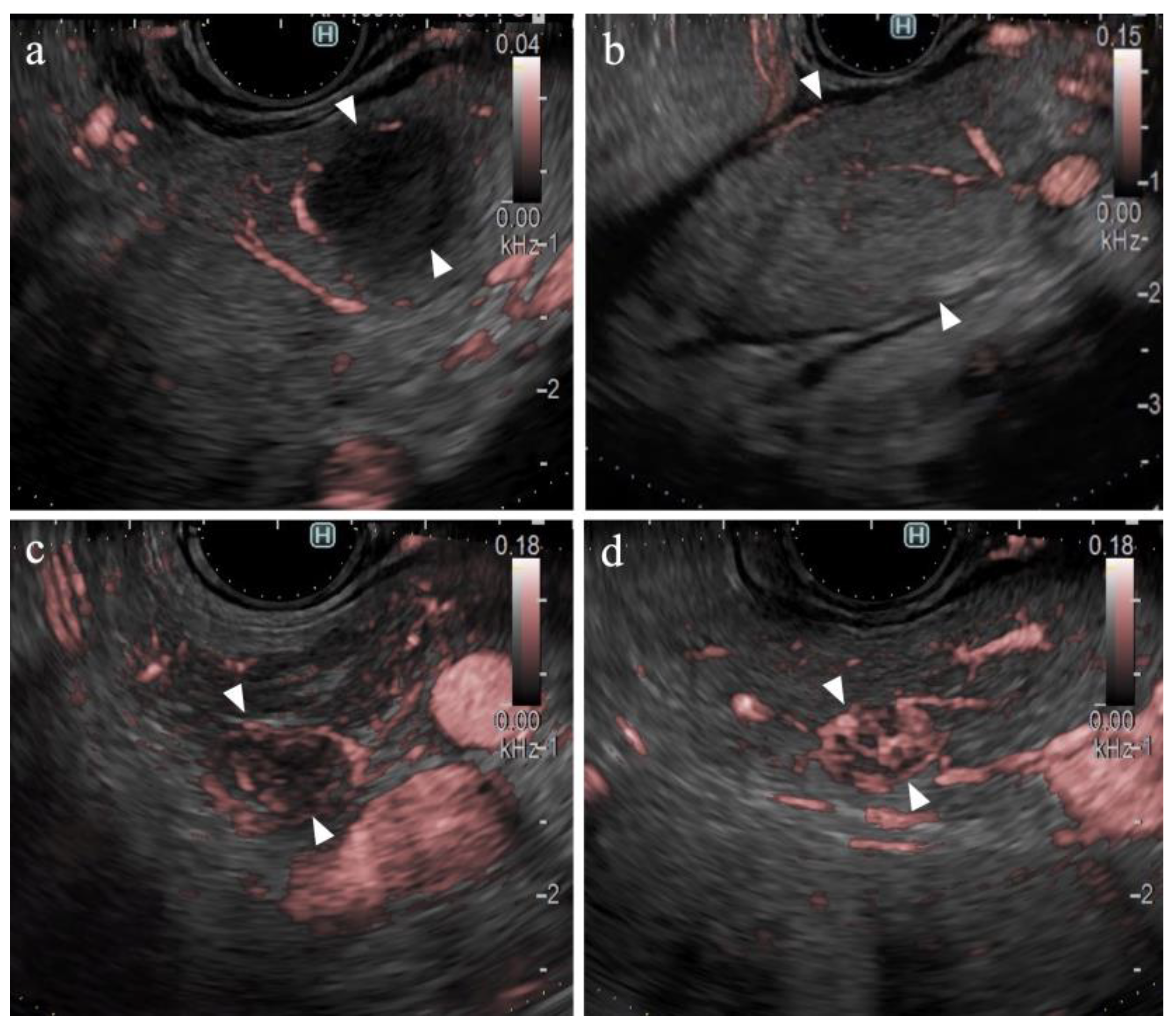 Diagnostics 14 00882 g004