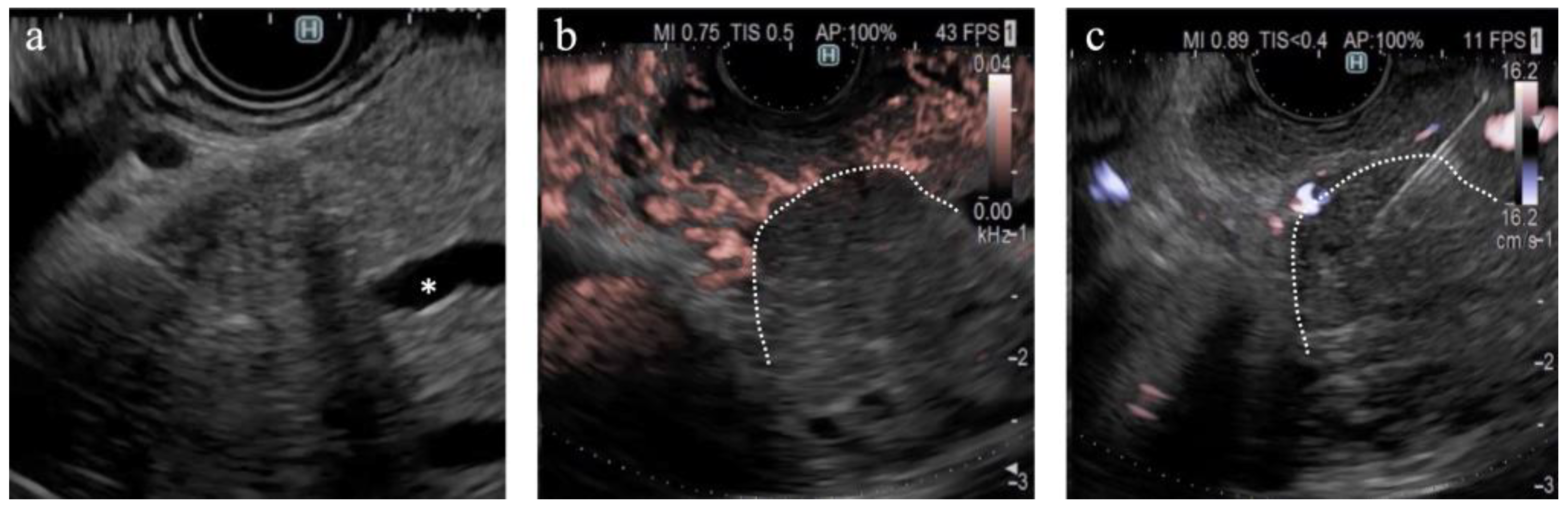 Diagnostics 14 00882 g005