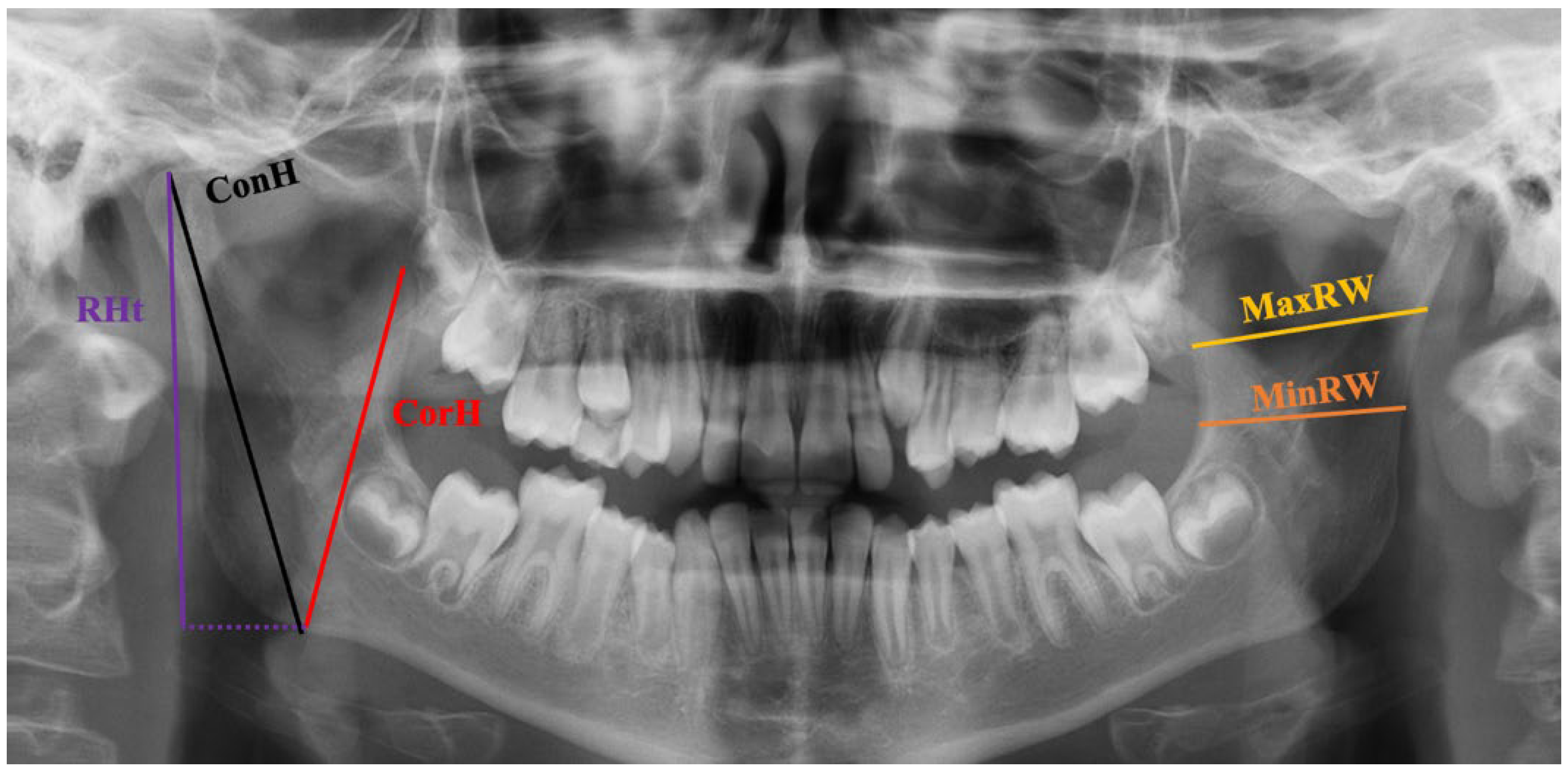 Diagnostics 14 00887 g002 Diagnostics 14 00887 g002