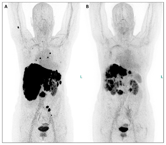 Diagnostics 14 00907 g001