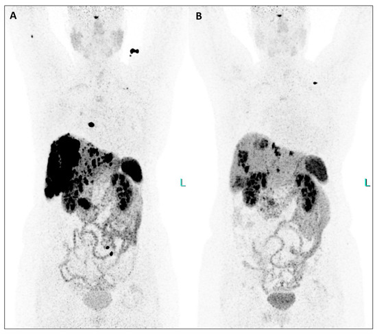 Diagnostics 14 00907 g002
