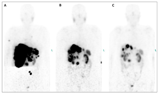 Diagnostics 14 00907 g003