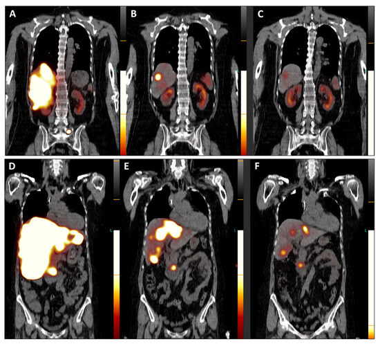 Diagnostics 14 00907 g004