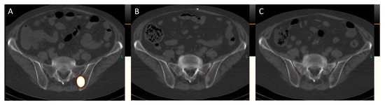 Diagnostics 14 00907 g006