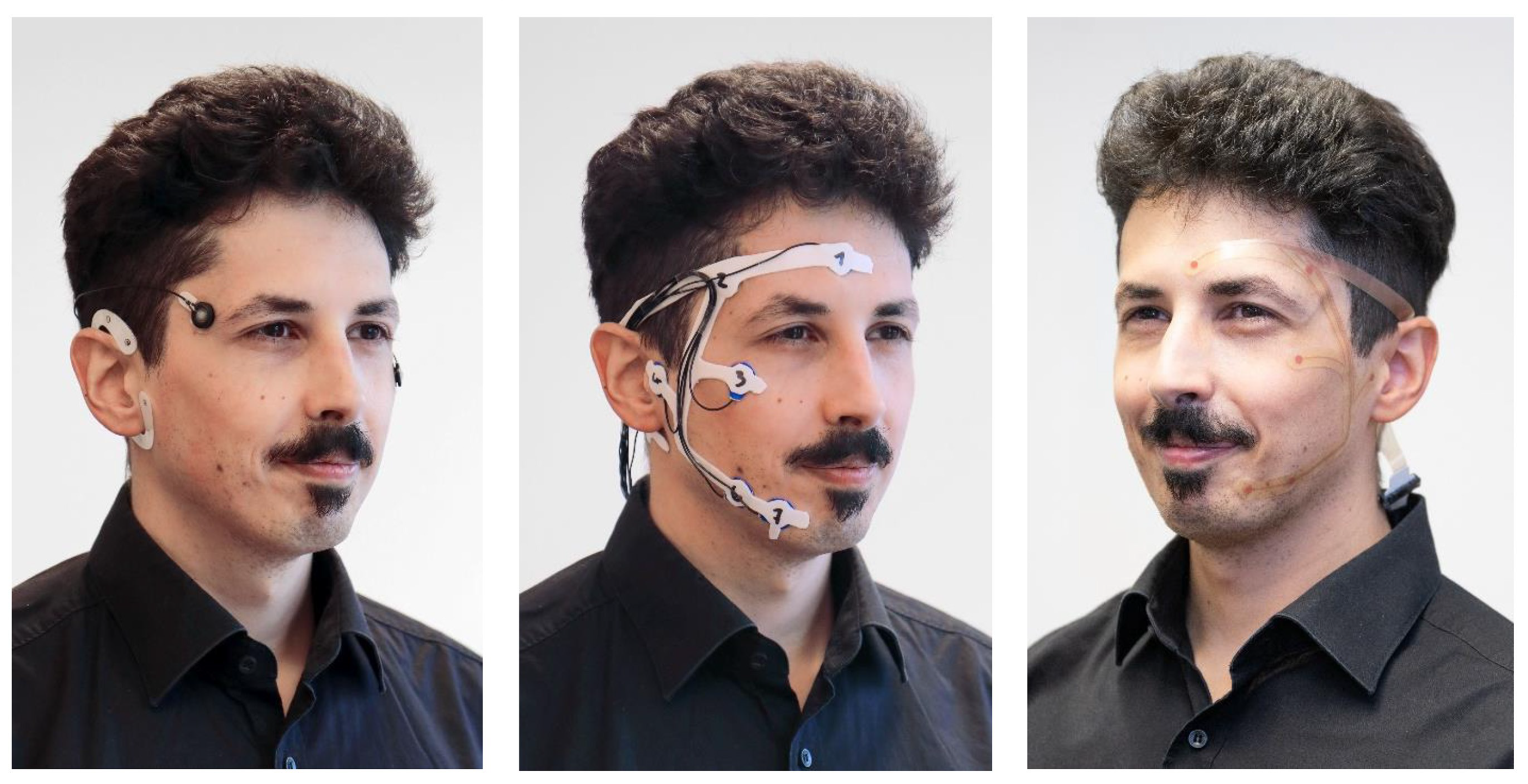 Diagnostics 14 00909 g001