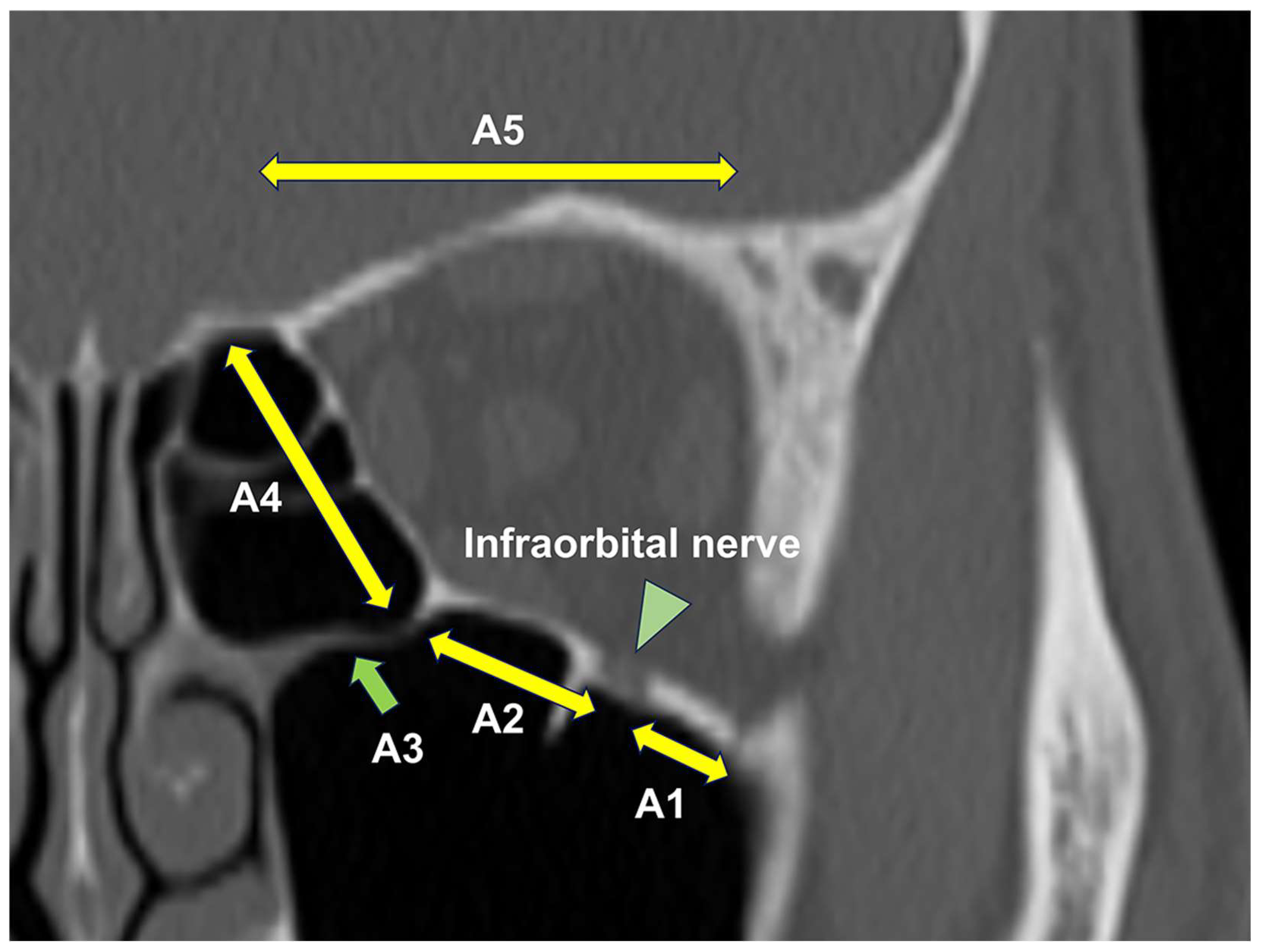 Diagnostics 14 00913 g001
