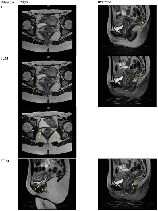 Diagnostics 14 00923 g0a1a