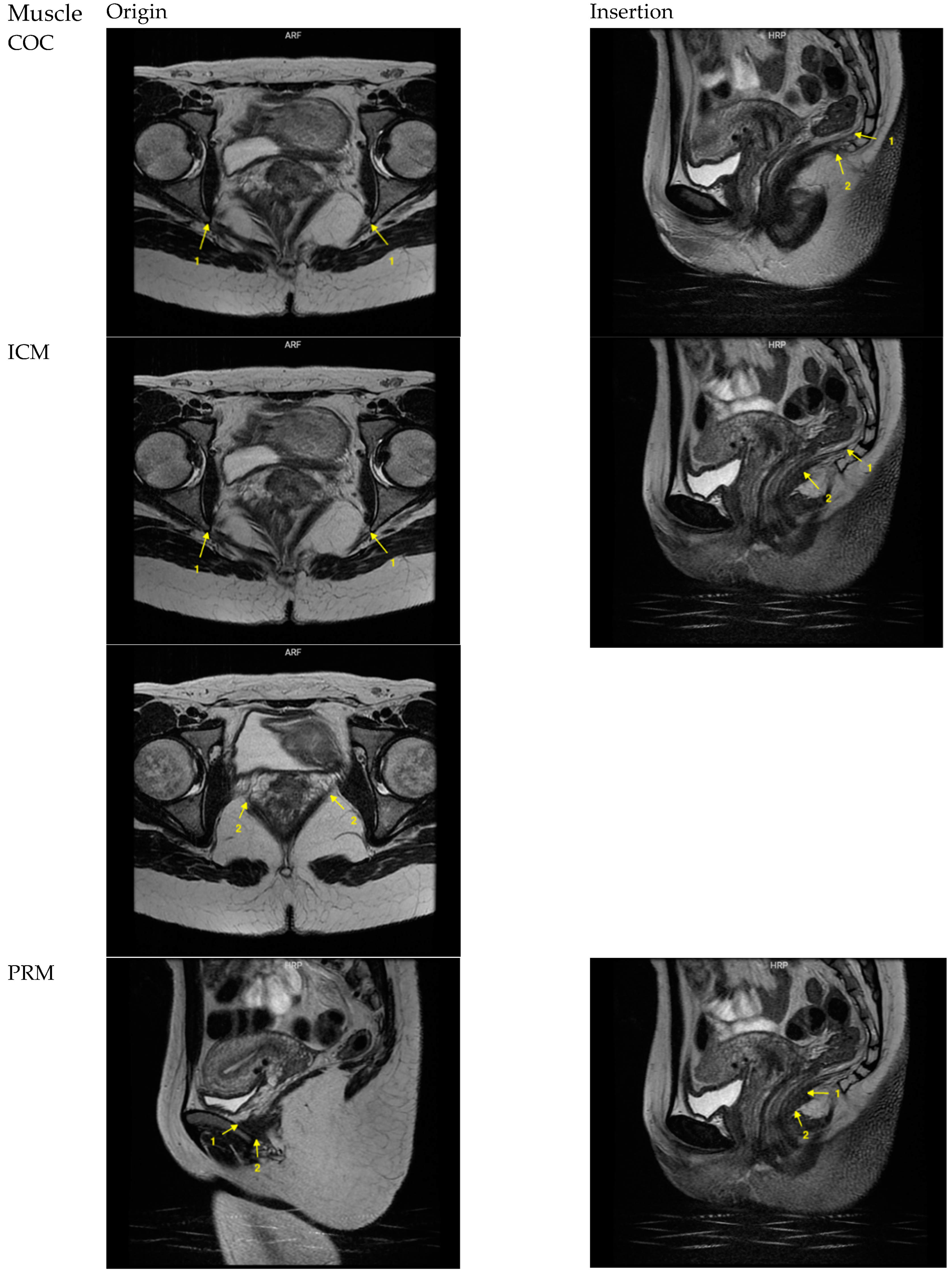 Diagnostics 14 00923 g0a1a