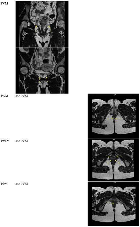 Diagnostics 14 00923 g0a1b