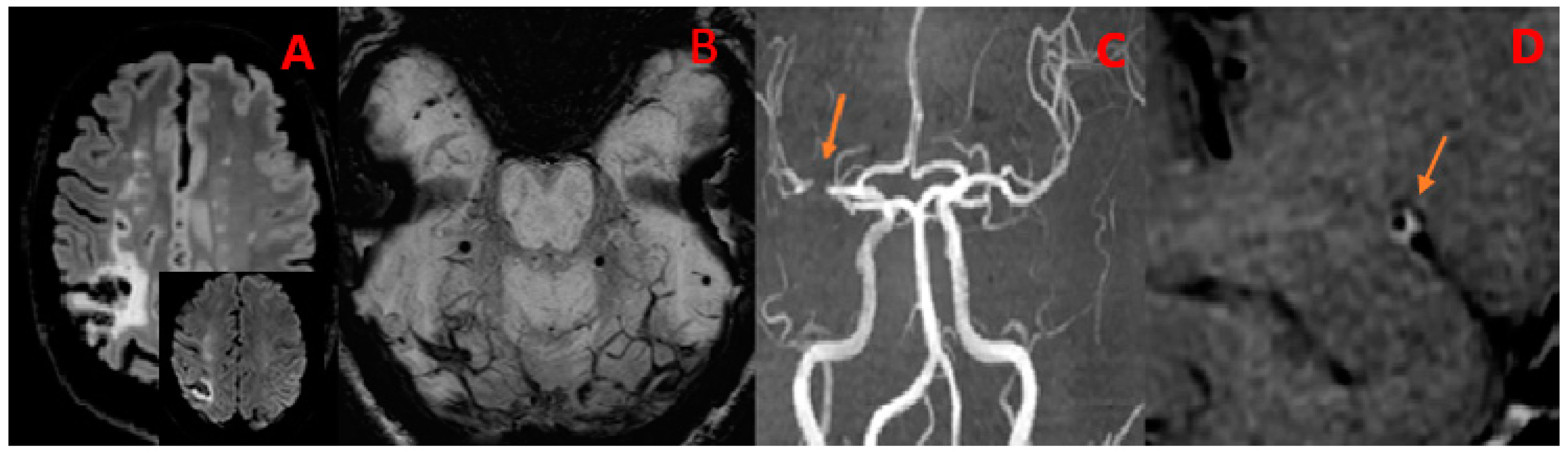 Diagnostics 14 00927 g001