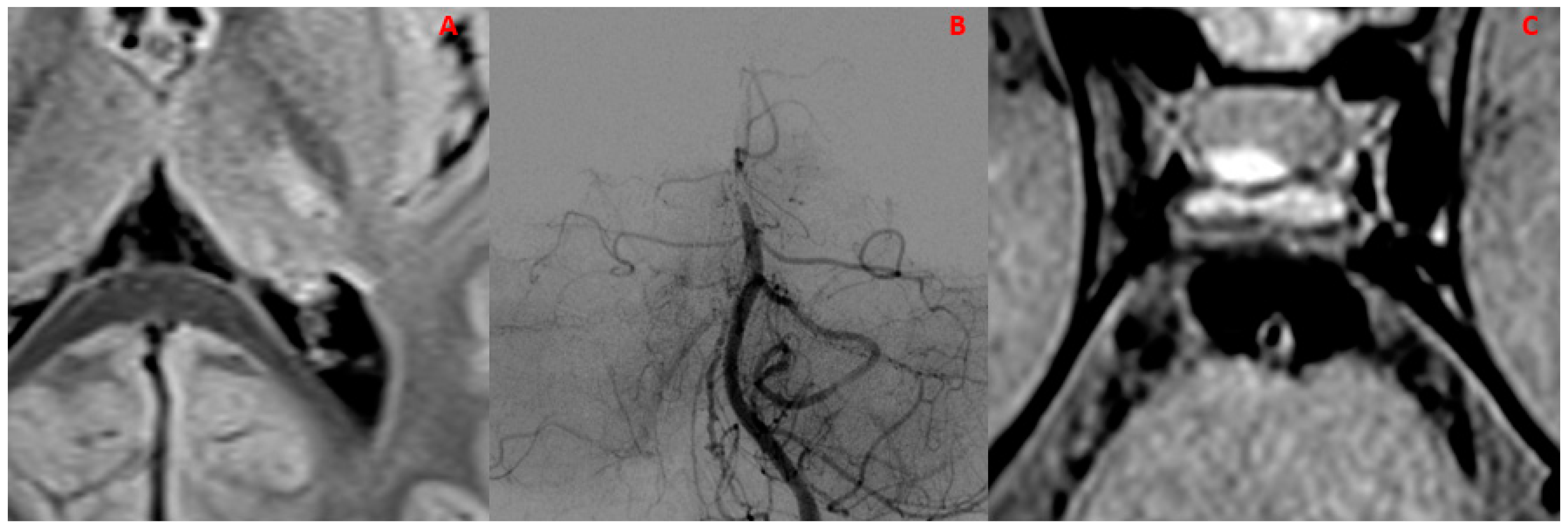Diagnostics 14 00927 g005