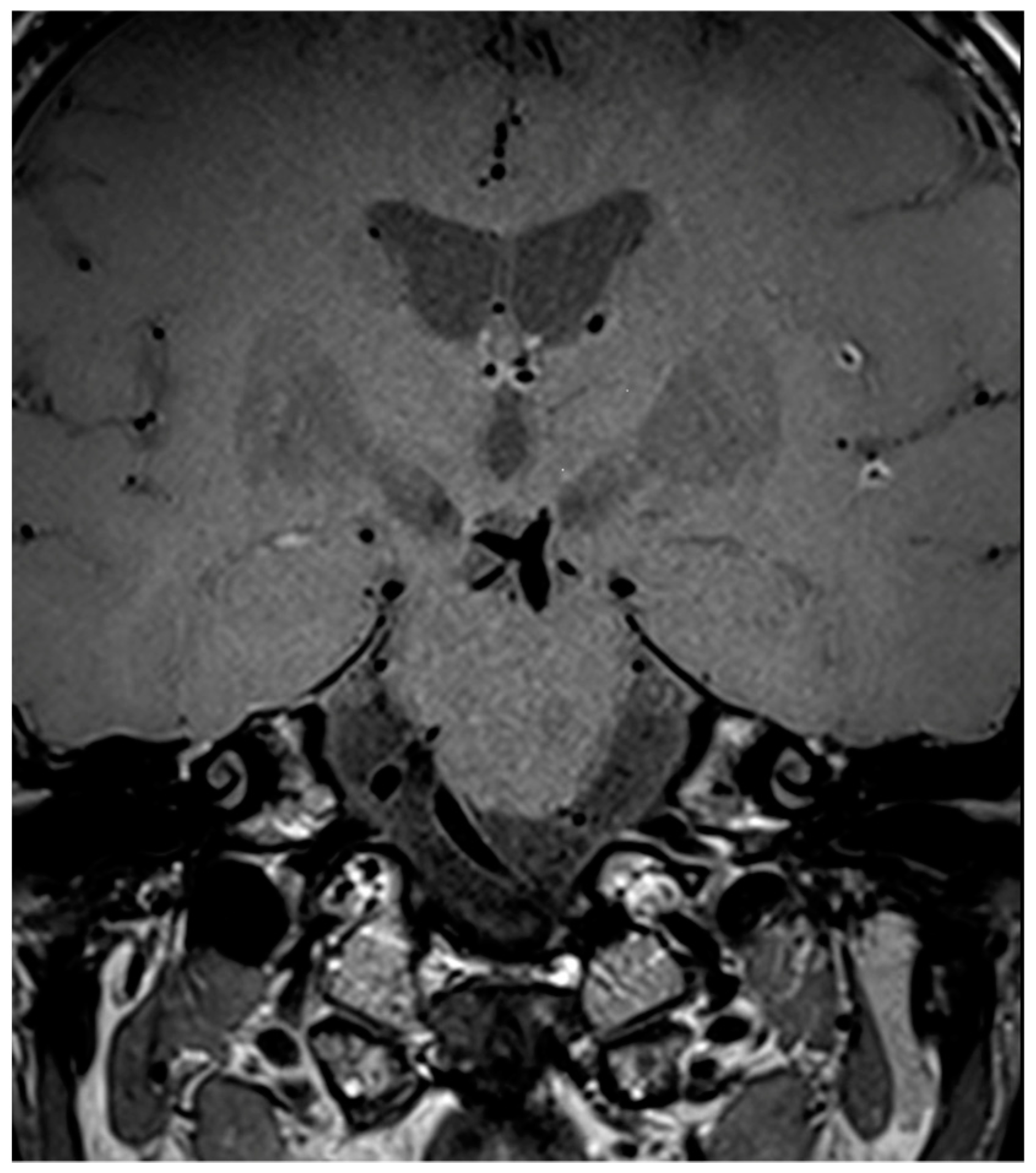 Diagnostics 14 00927 g007