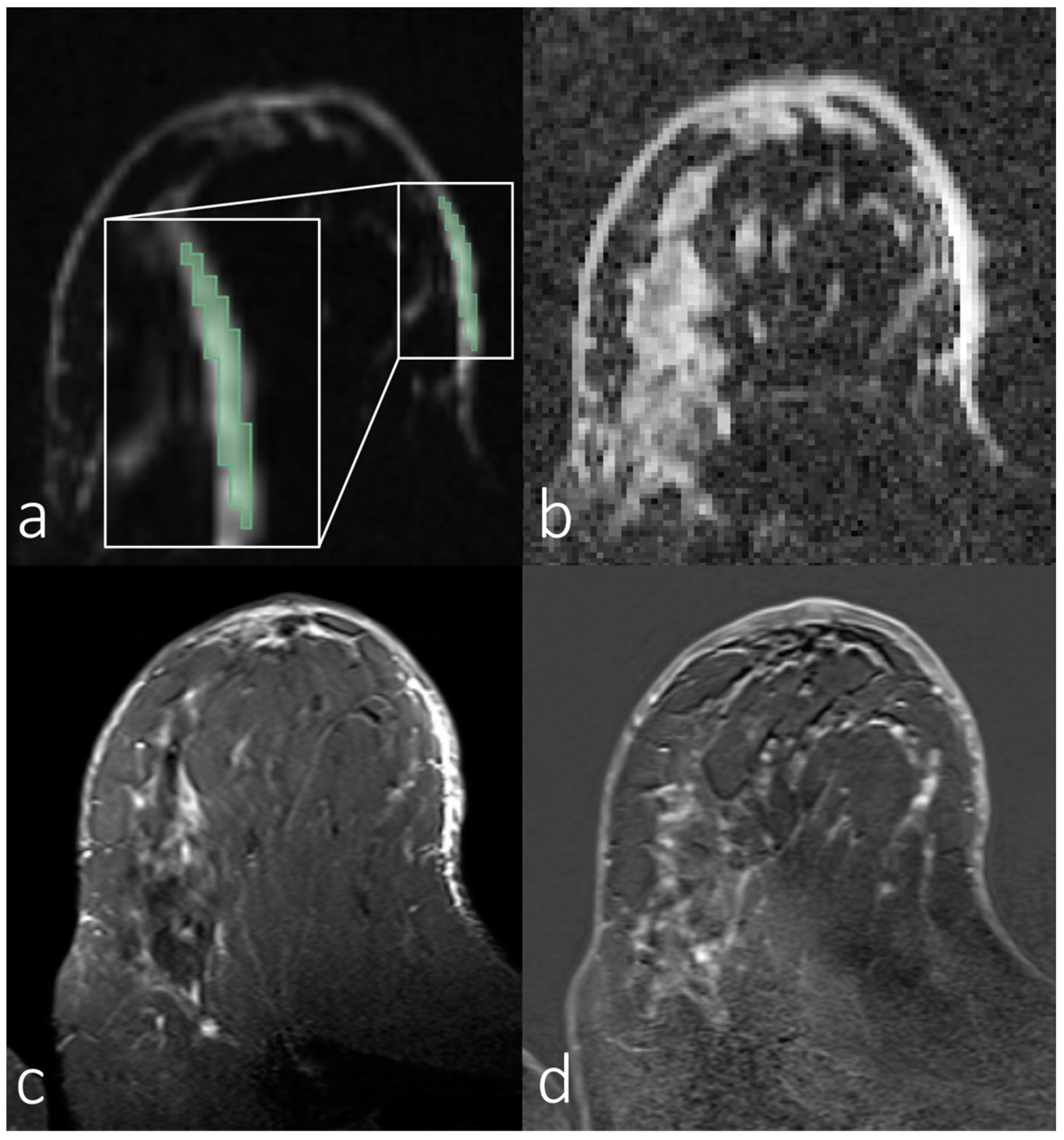 Diagnostics 14 00934 g004