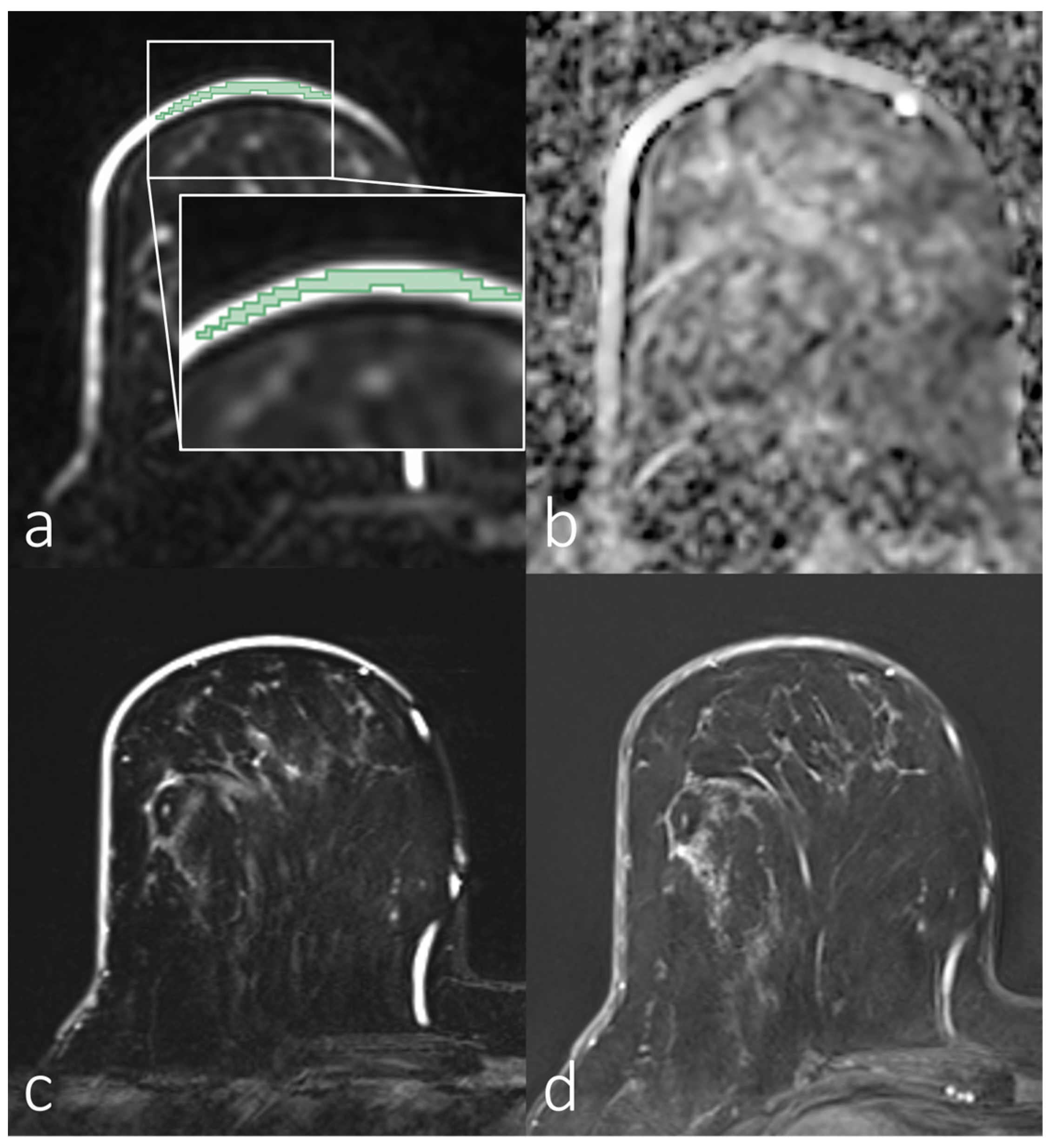 Diagnostics 14 00934 g005