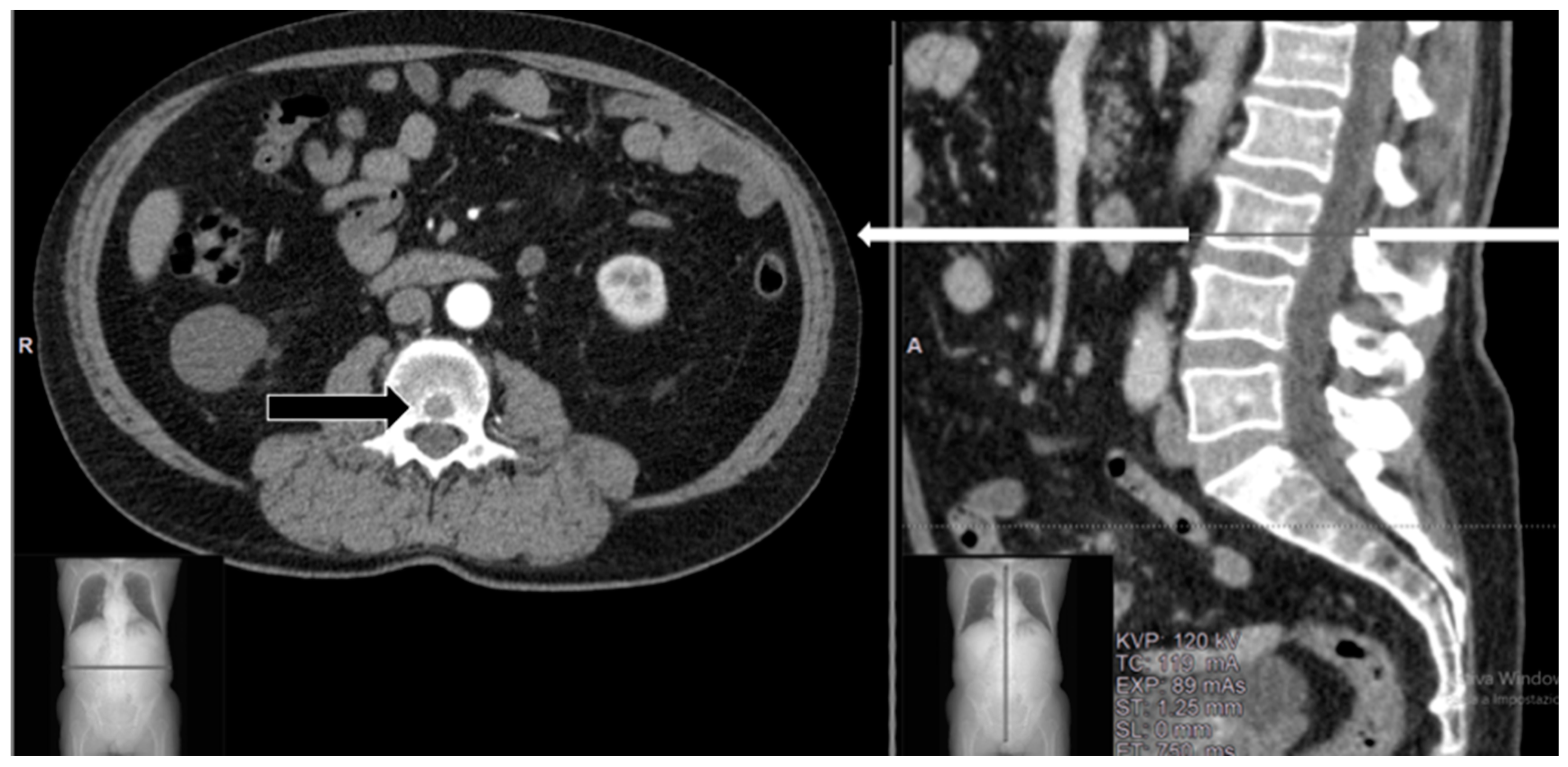 Diagnostics 14 00936 g002