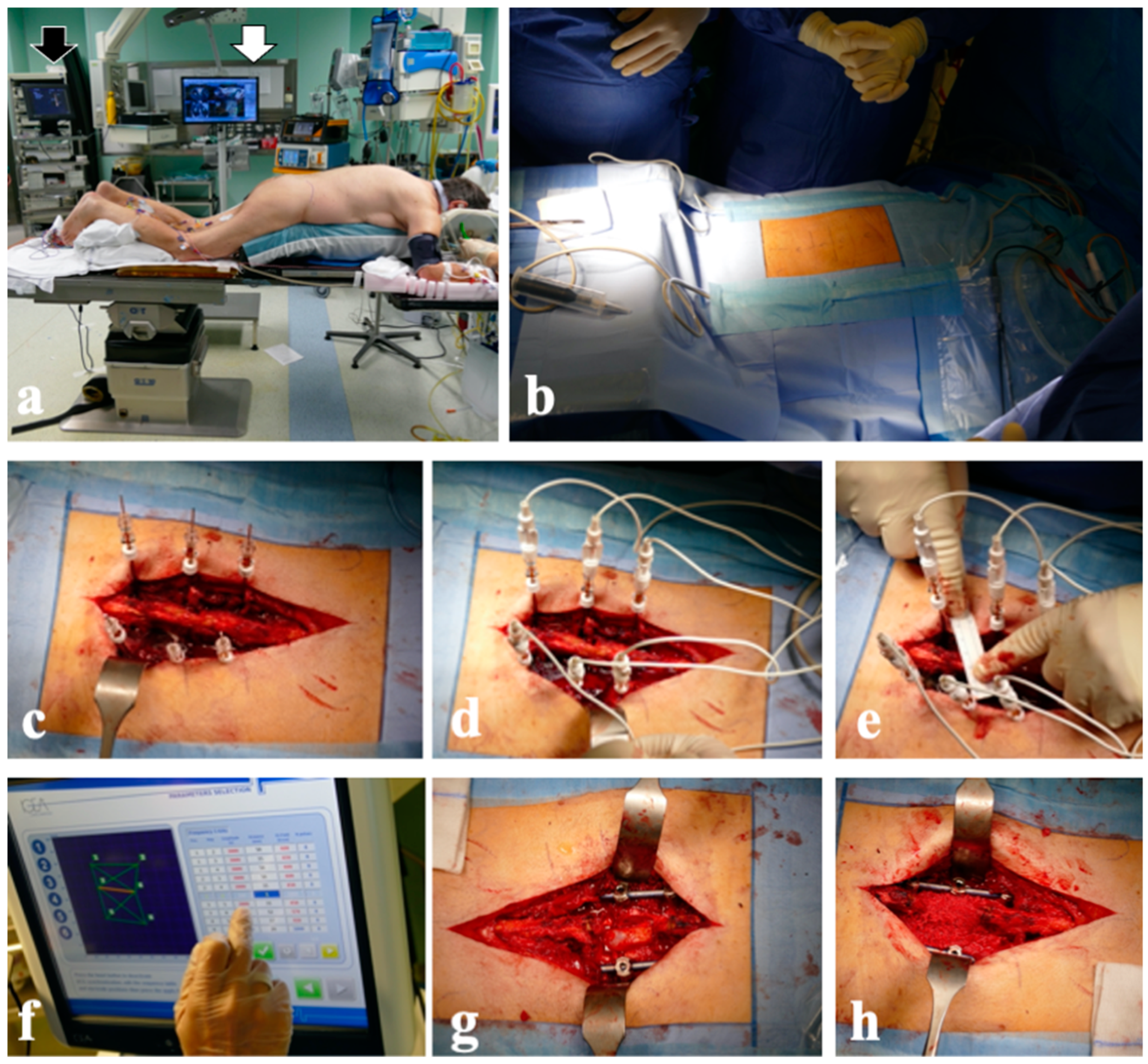Diagnostics 14 00936 g004