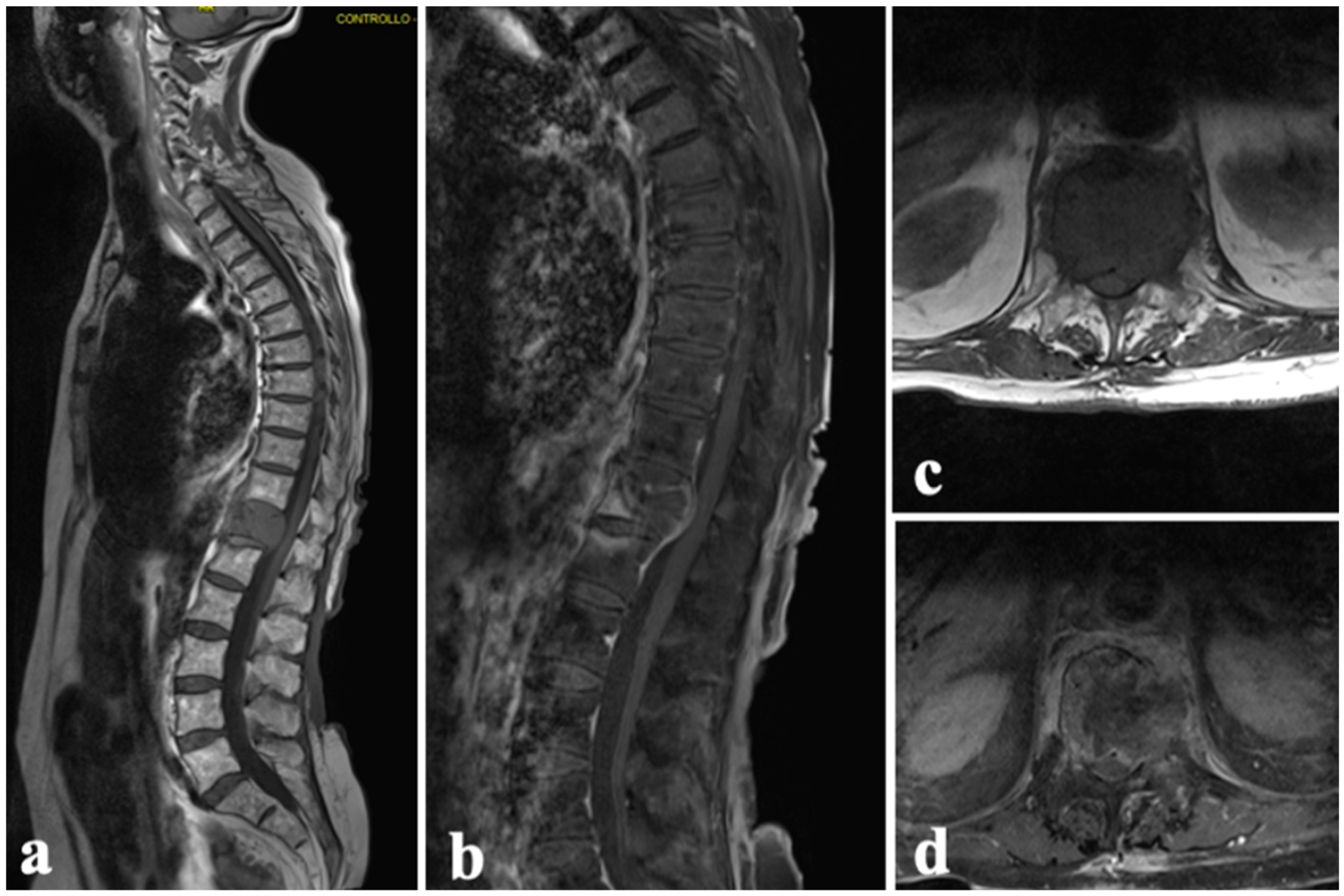 Diagnostics 14 00936 g006
