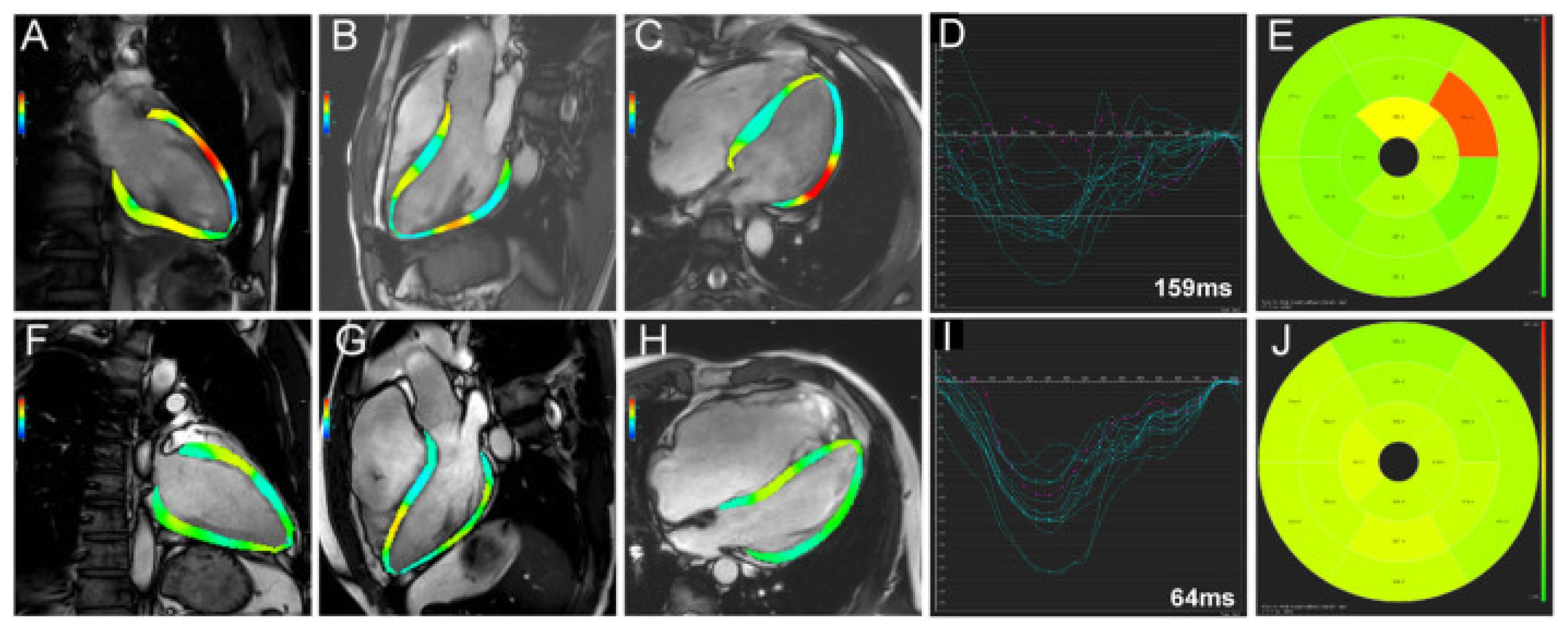 Diagnostics 14 00937 g005
