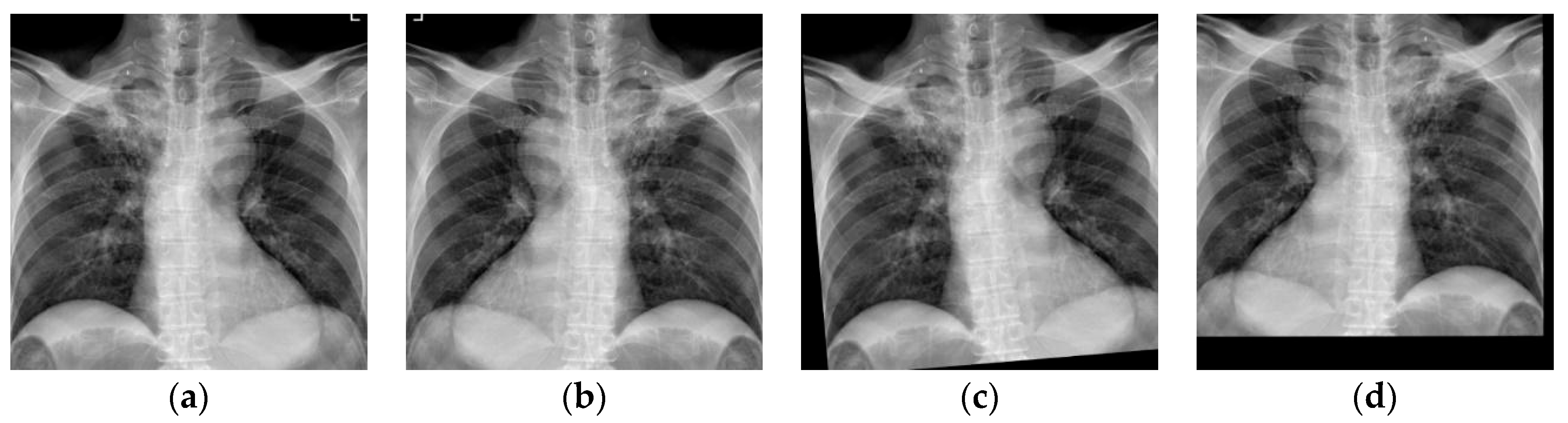Diagnostics 14 00952 g008 Diagnostics 14 00952 g008