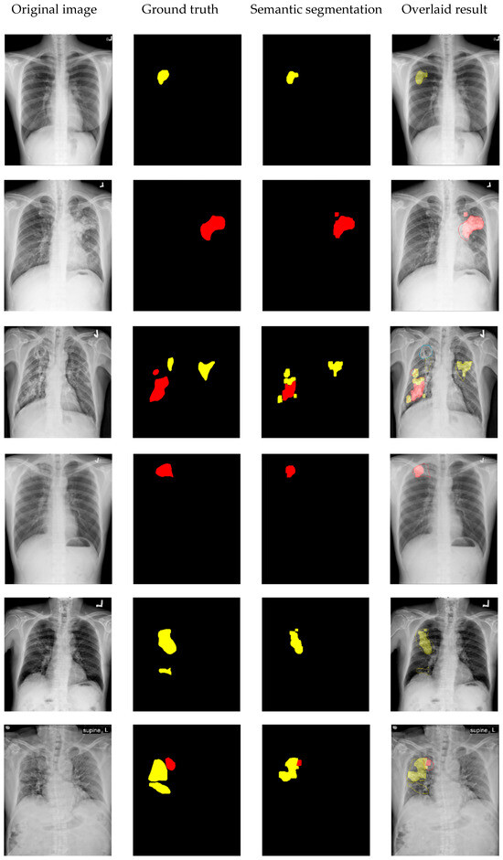 Diagnostics 14 00952 g015a Diagnostics 14 00952 g015a