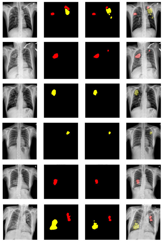 Diagnostics 14 00952 g015b Diagnostics 14 00952 g015b