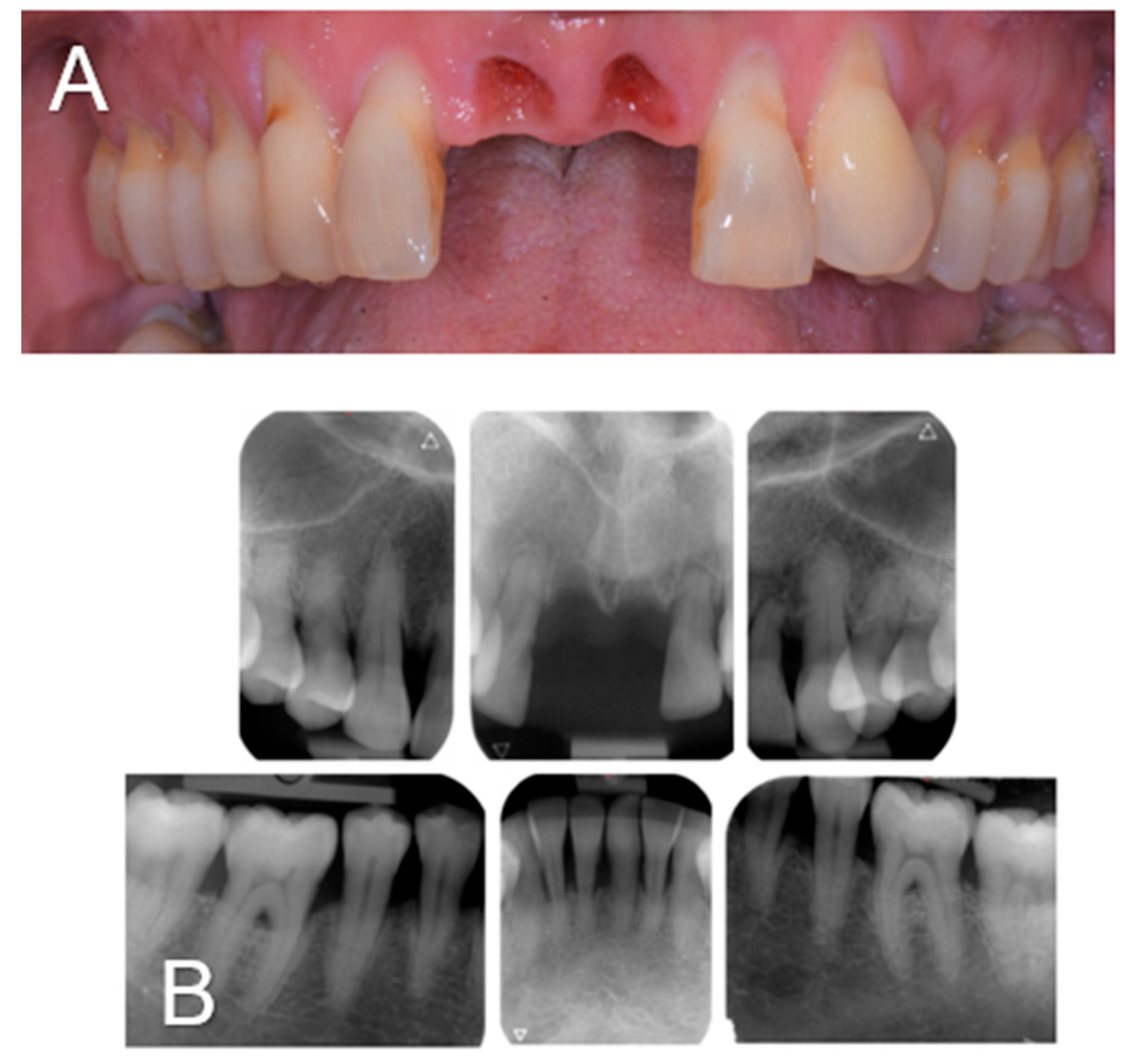 Diagnostics 14 00966 g001