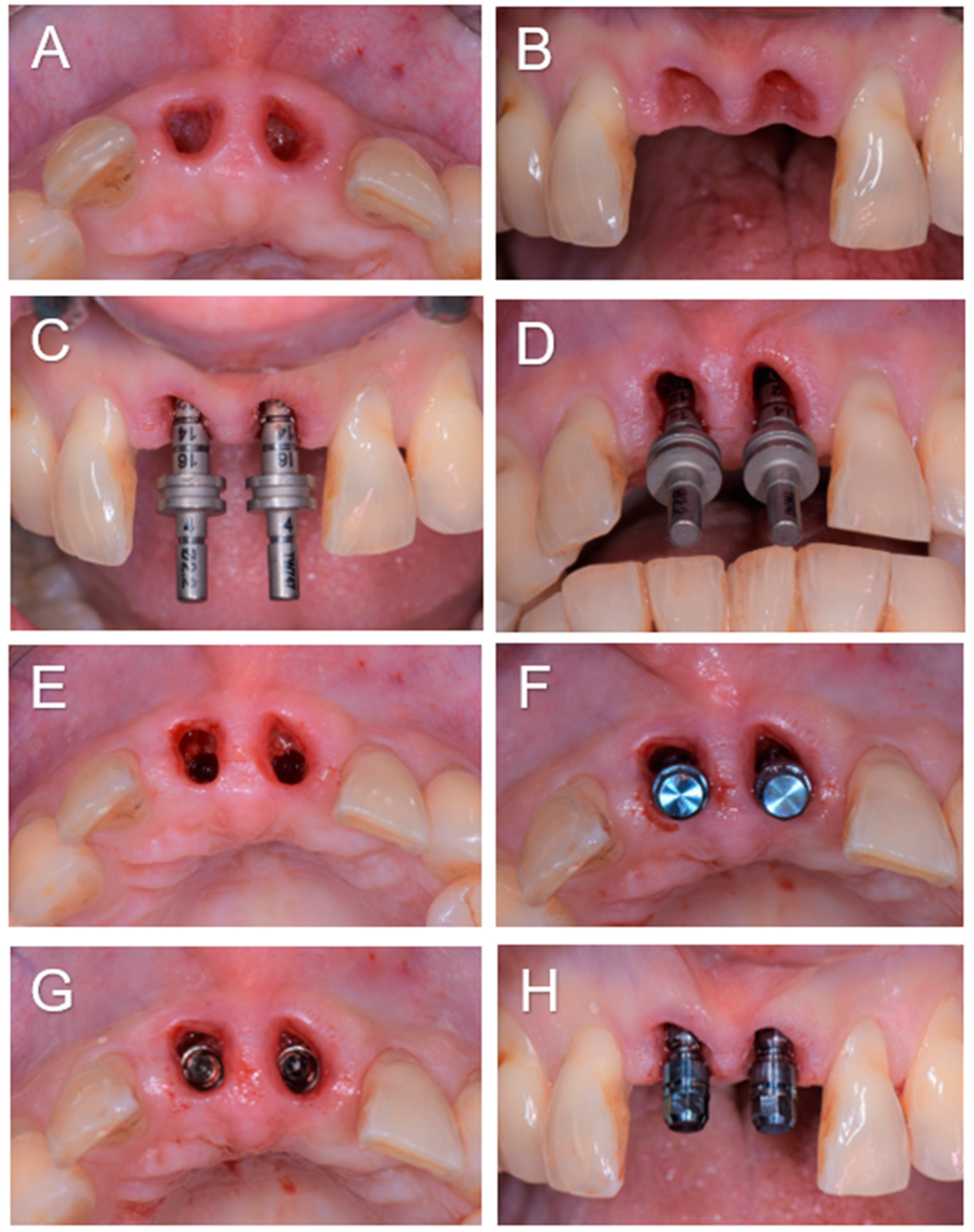 Diagnostics 14 00966 g002a