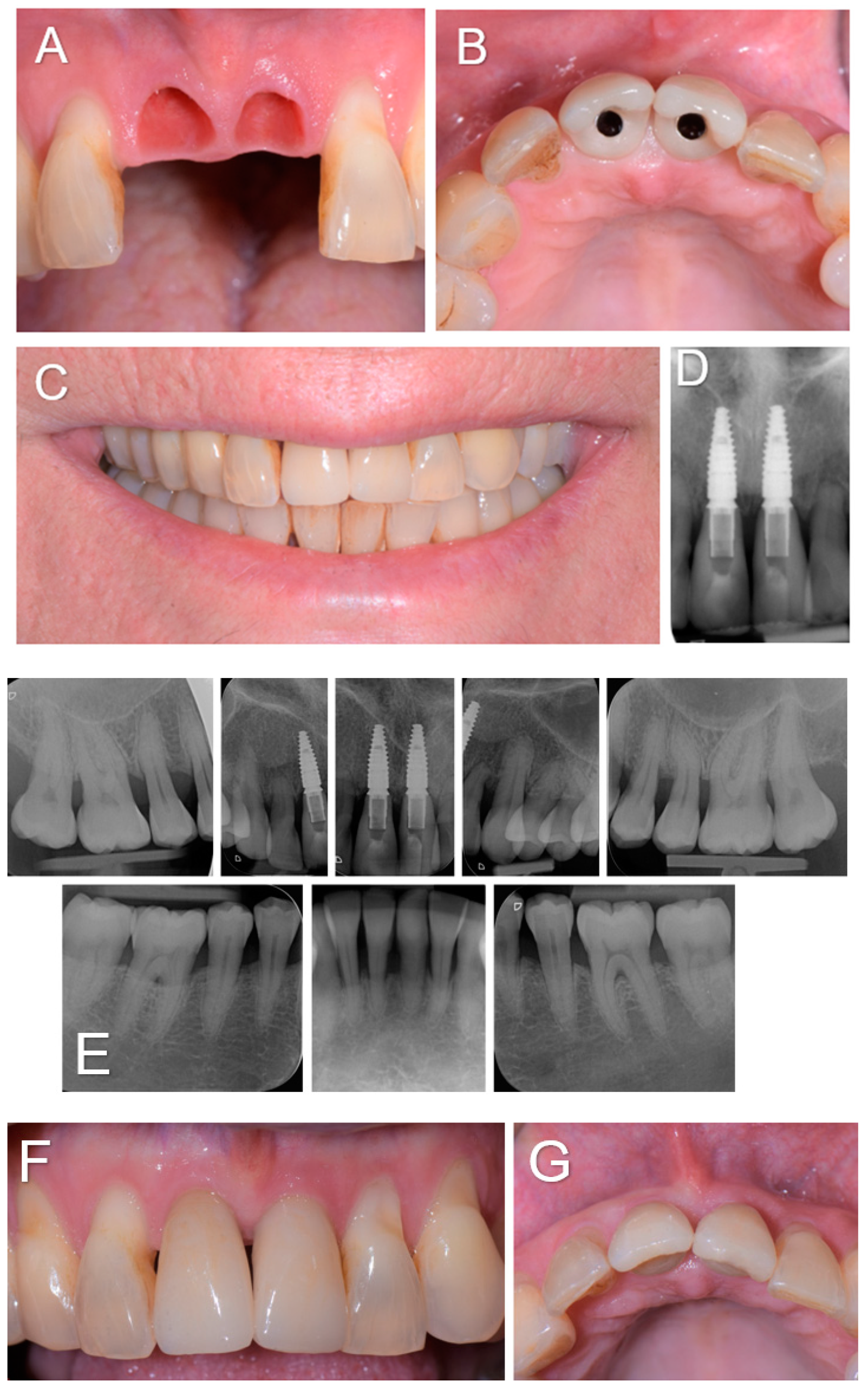 Diagnostics 14 00966 g003