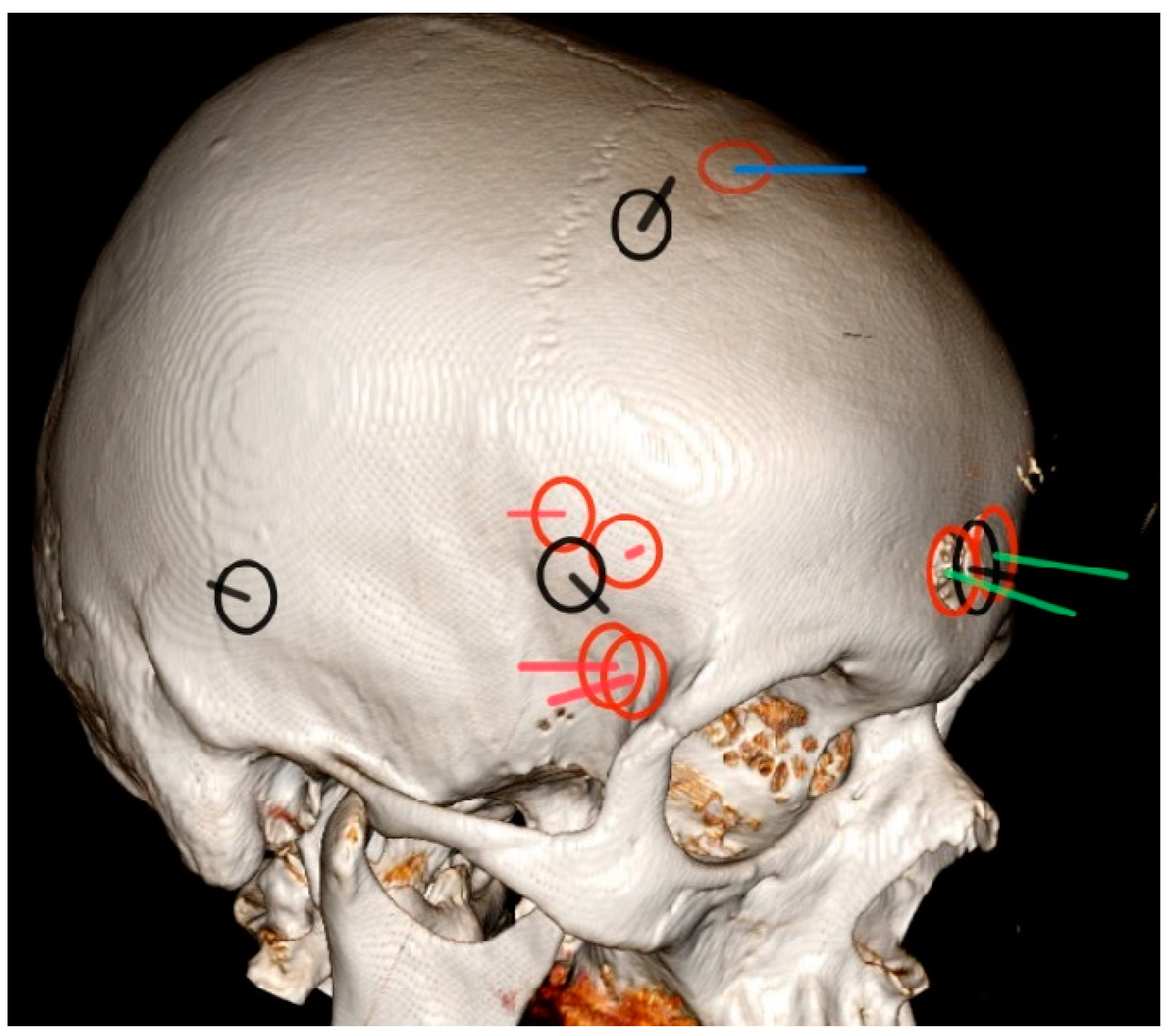 Diagnostics 14 00977 g001