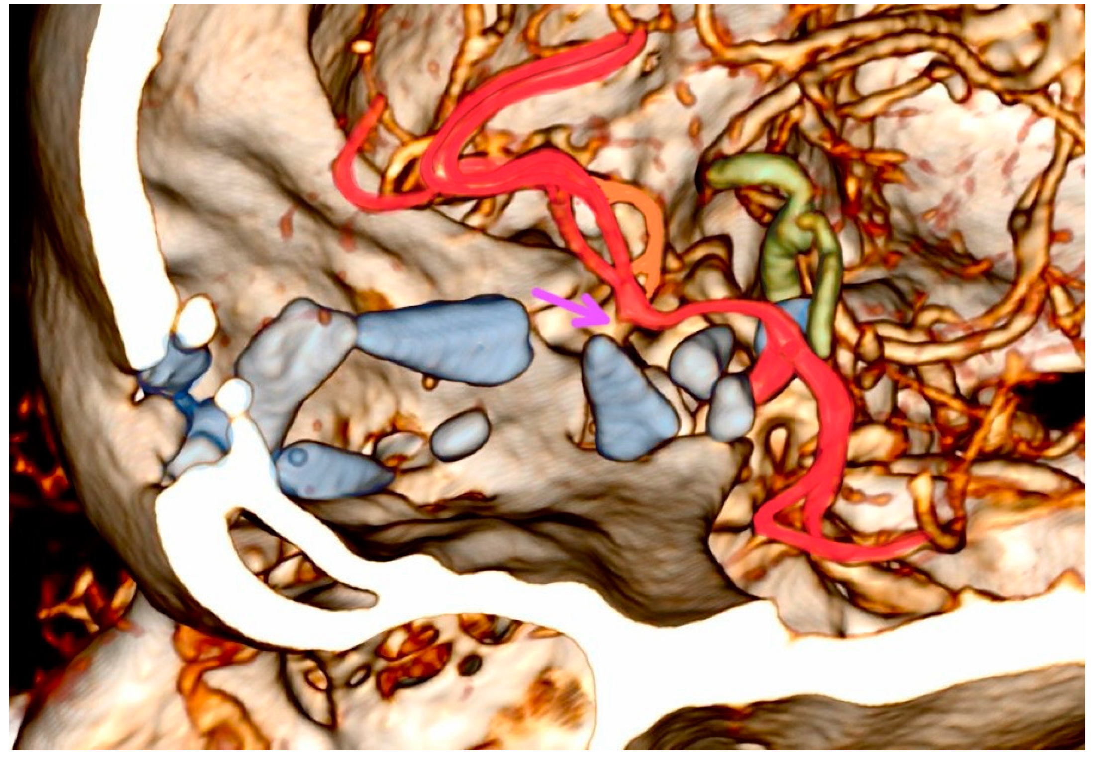 Diagnostics 14 00977 g002