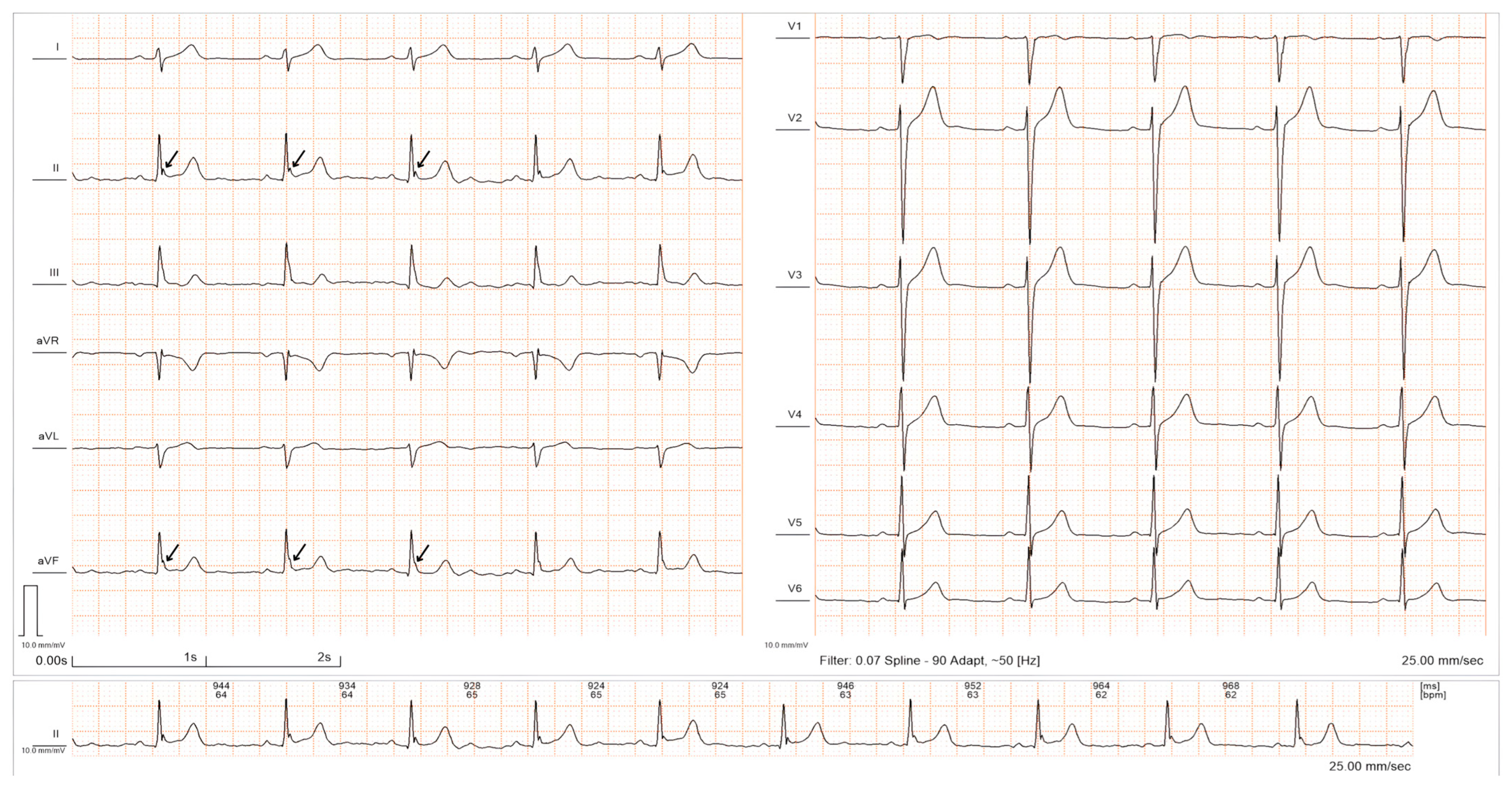Diagnostics 14 00980 g001 Diagnostics 14 00980 g001