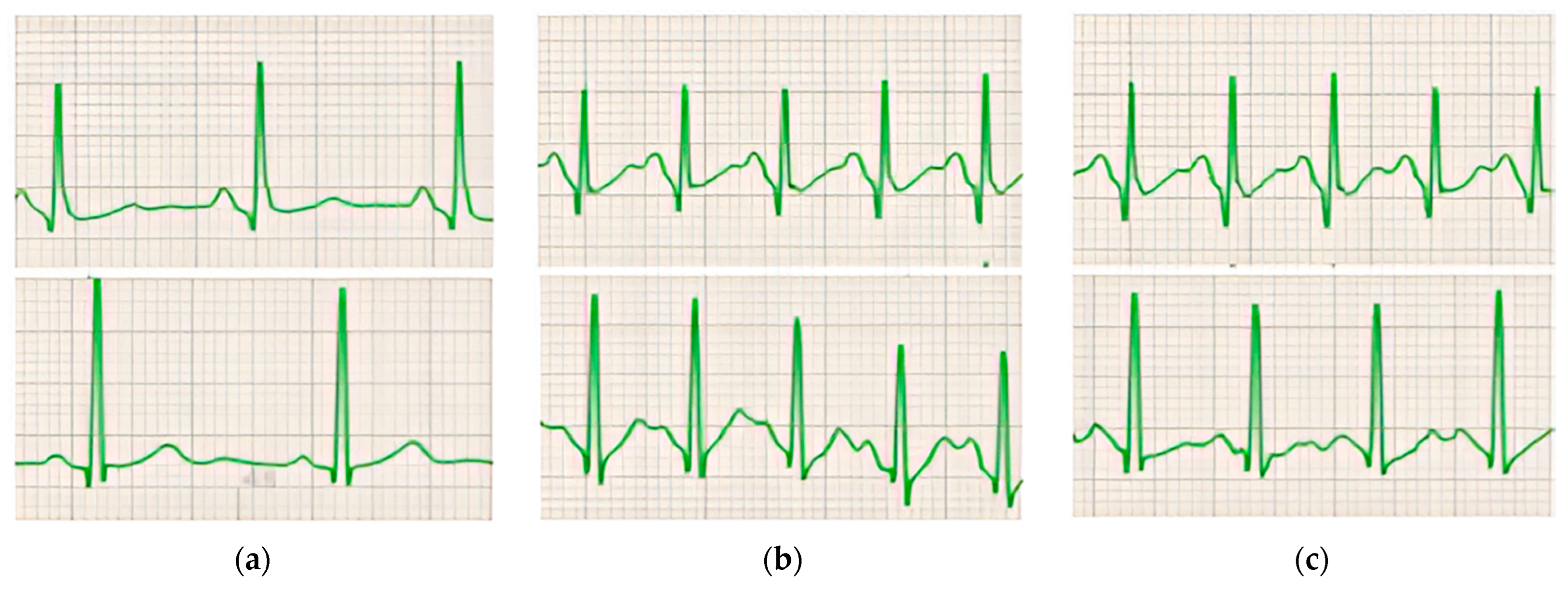 Diagnostics 14 00980 g002 Diagnostics 14 00980 g002