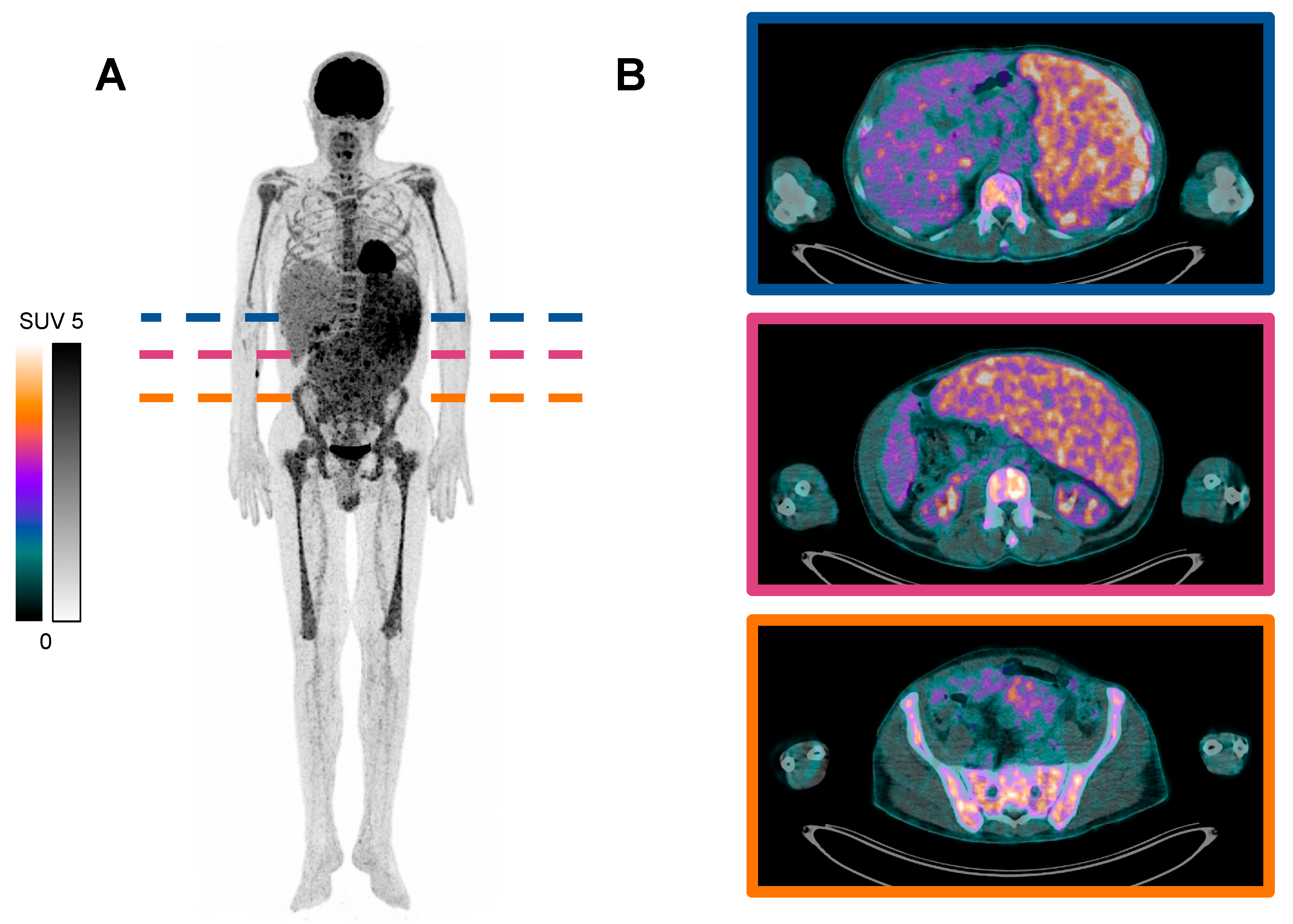 Diagnostics 14 00982 g001