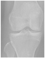 Diagnostics 14 00993 i002