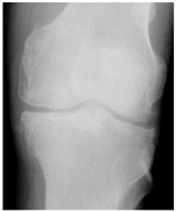 Diagnostics 14 00993 i003